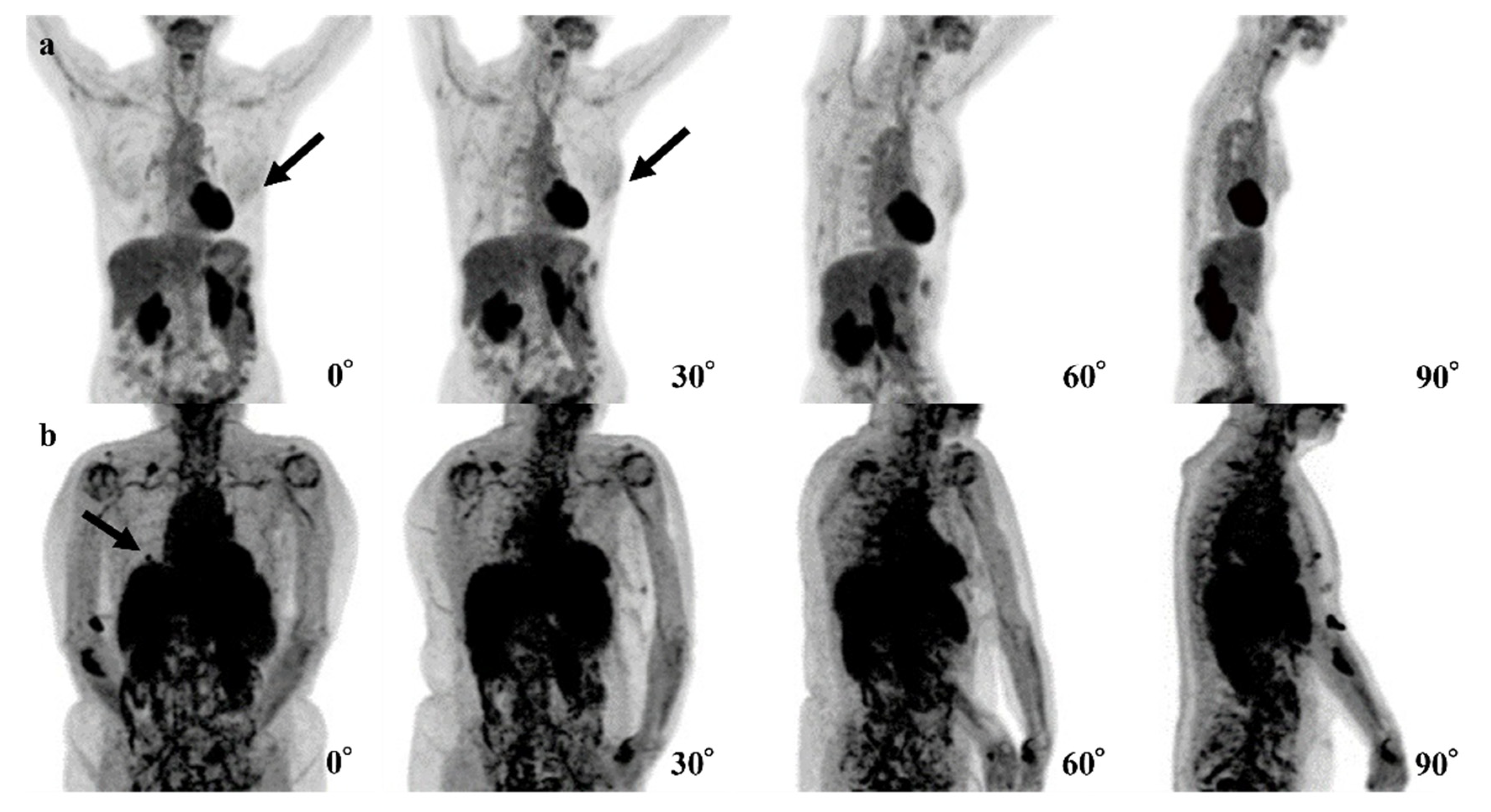 Tomography 08 00011 g004