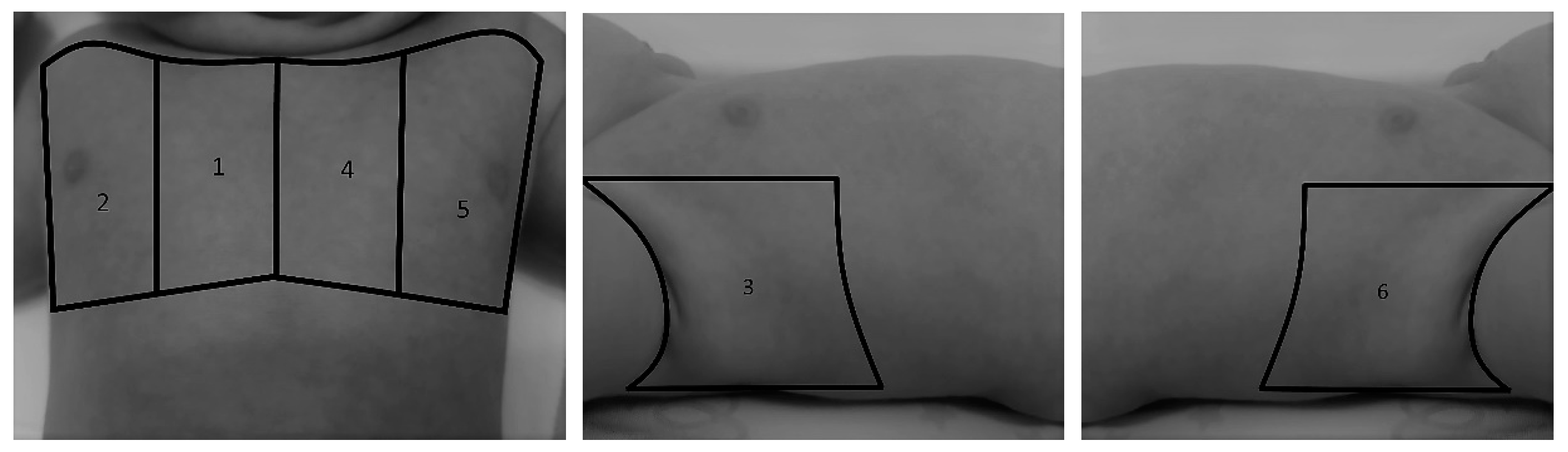 Tomography 08 00012 g001