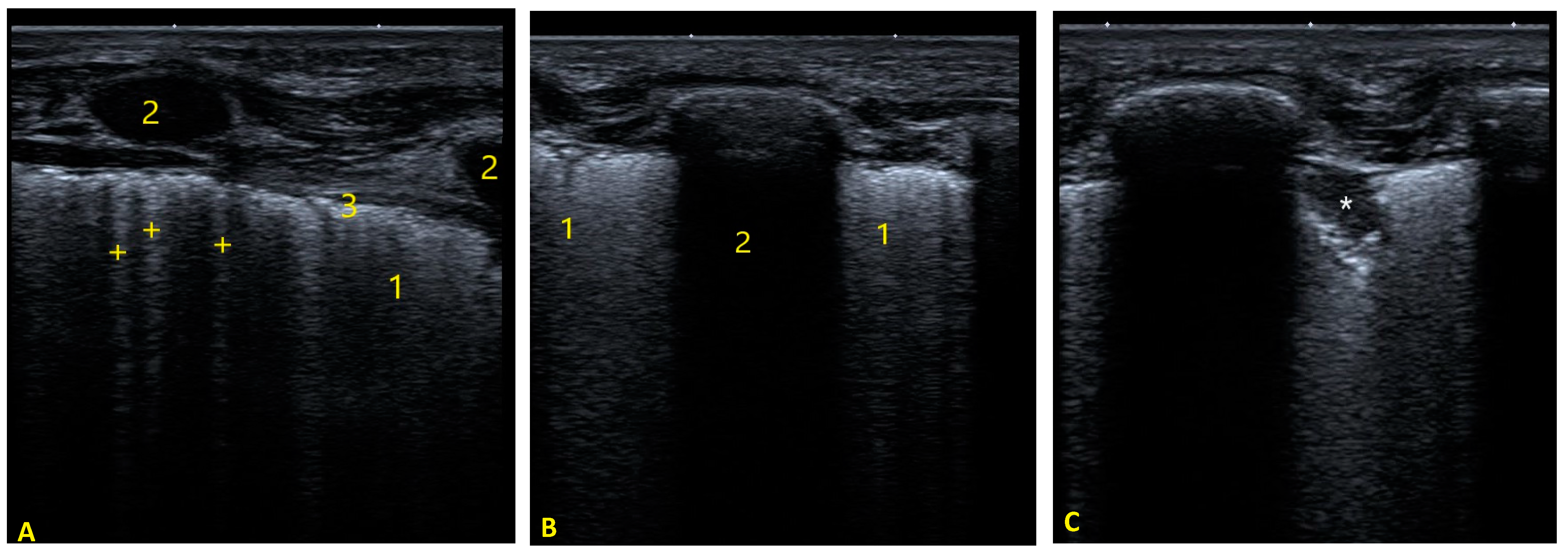 Tomography 08 00012 g003