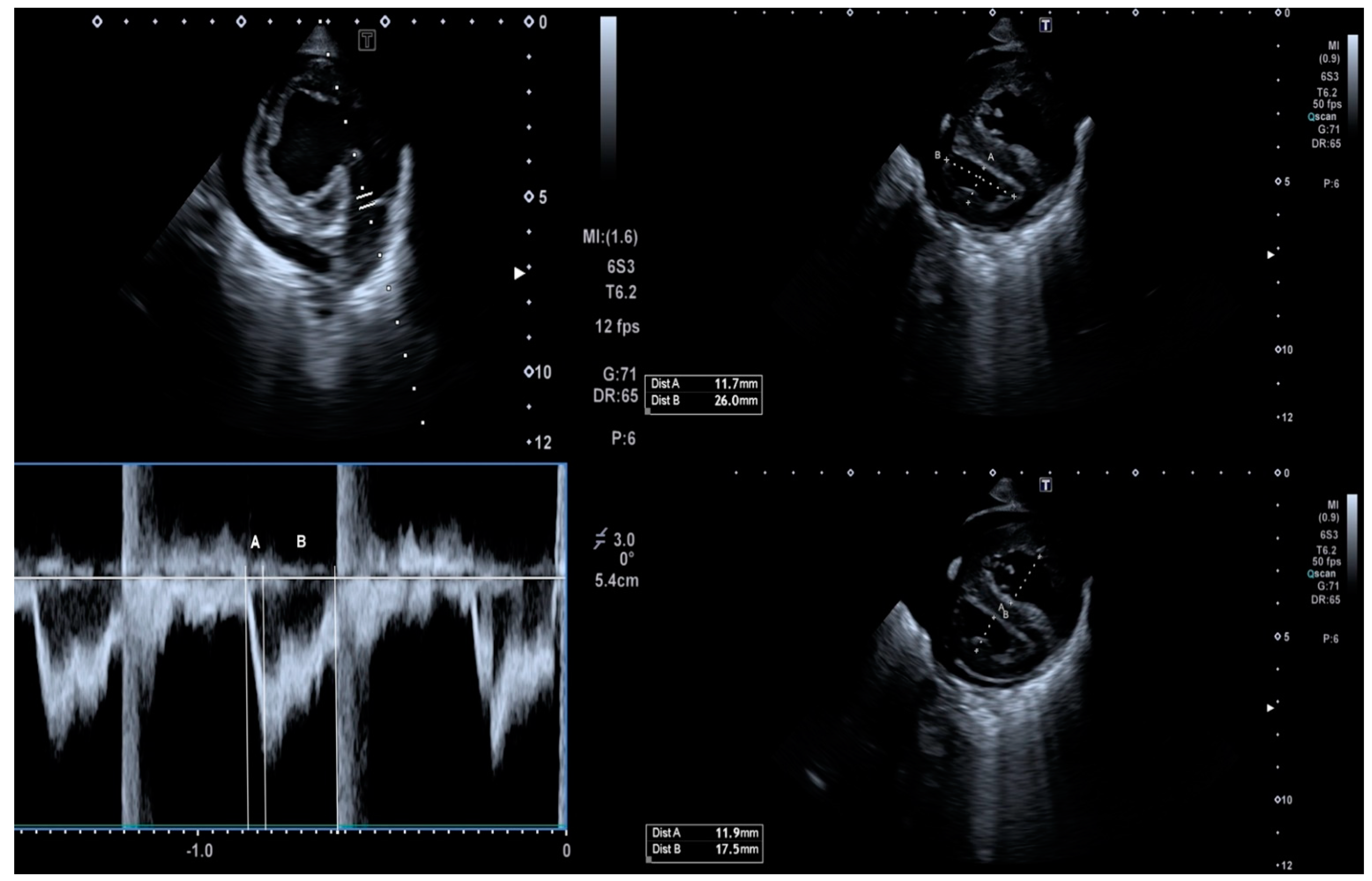 Tomography 08 00012 g004