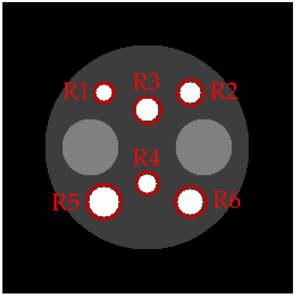 Tomography 08 00013 g005