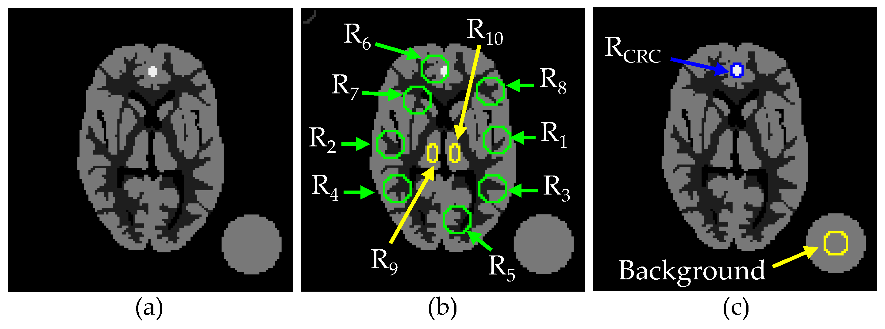 Tomography 08 00013 g006