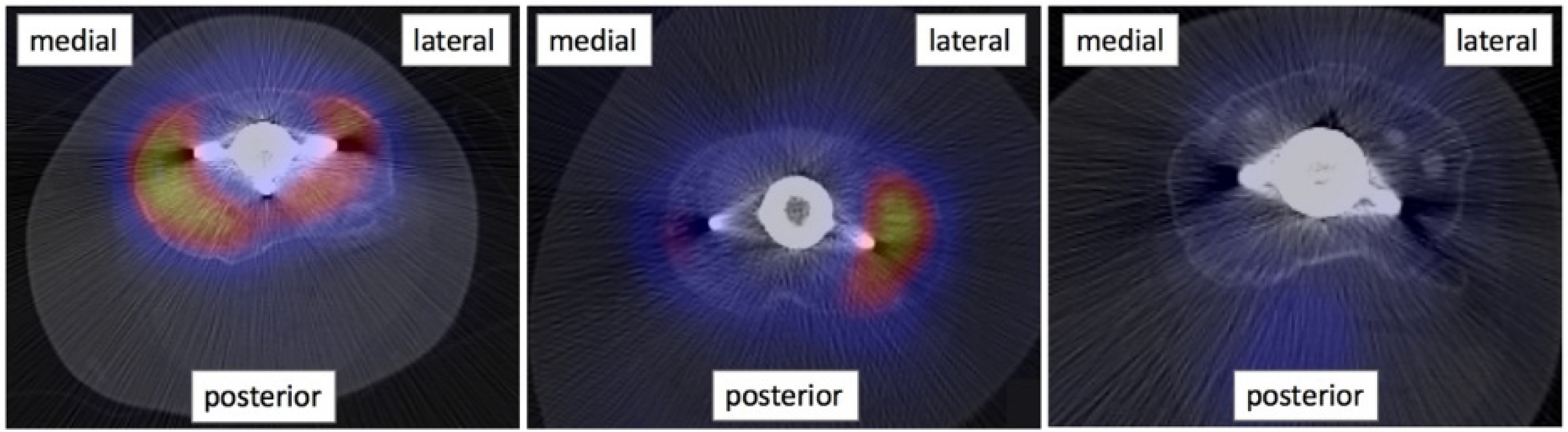 Tomography 08 00015 g003