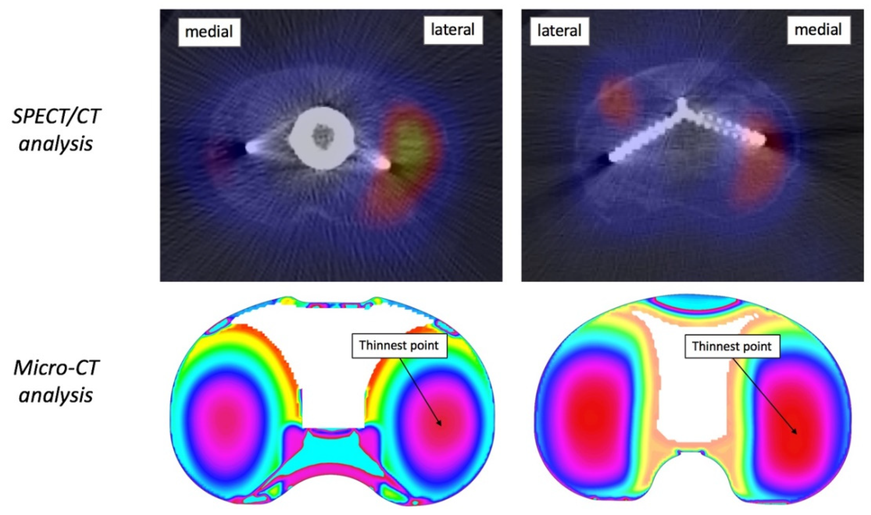 Tomography 08 00015 g006