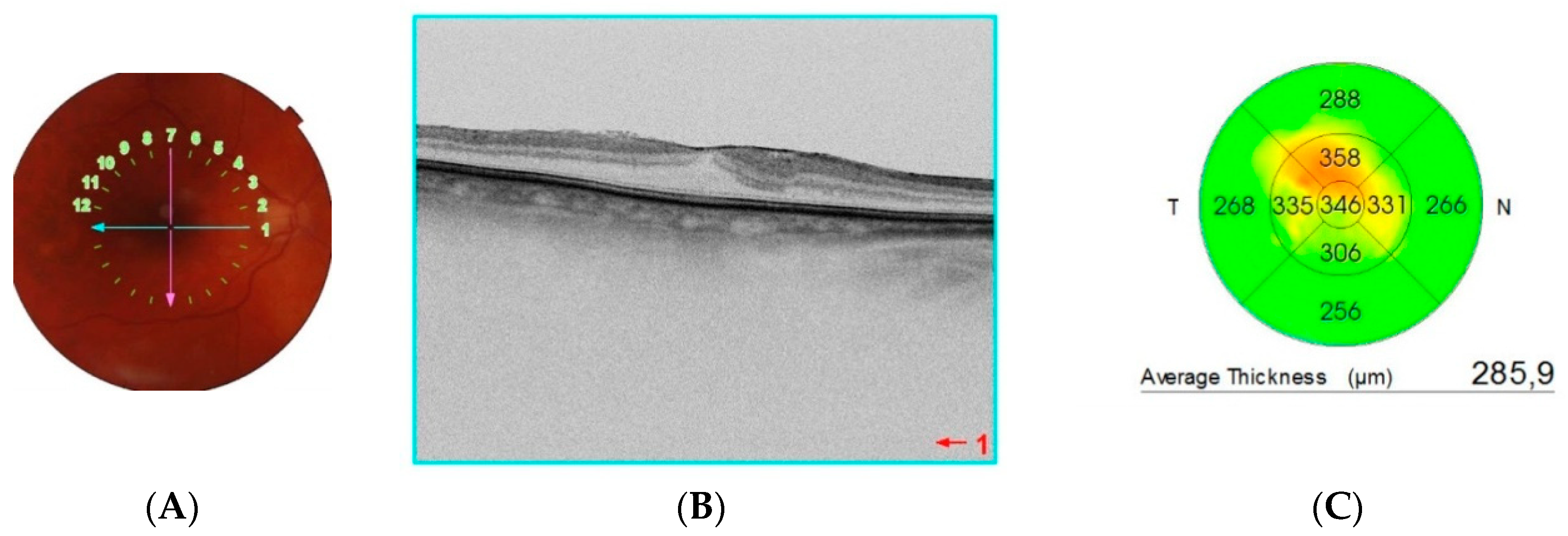 Tomography 08 00016 g001 Tomography 08 00016 g001
