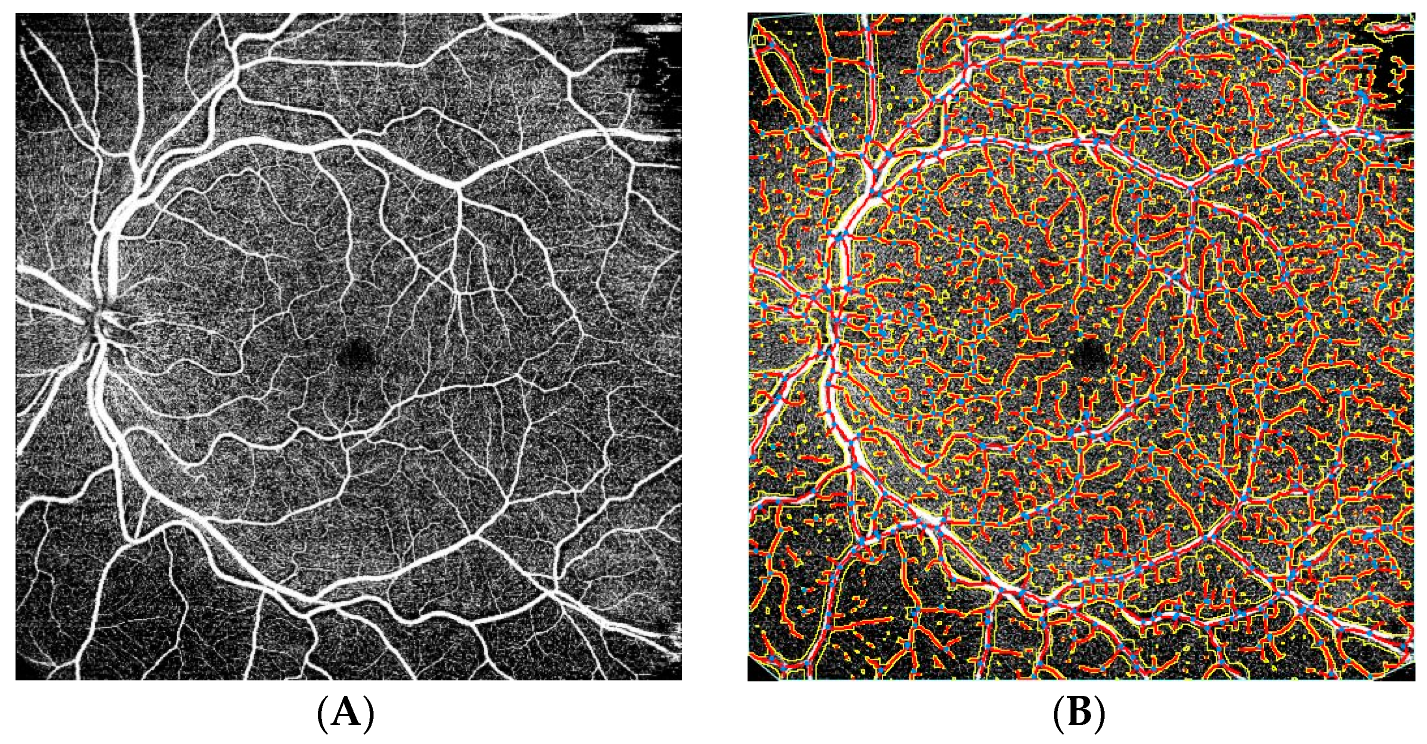 Tomography 08 00016 g002 Tomography 08 00016 g002