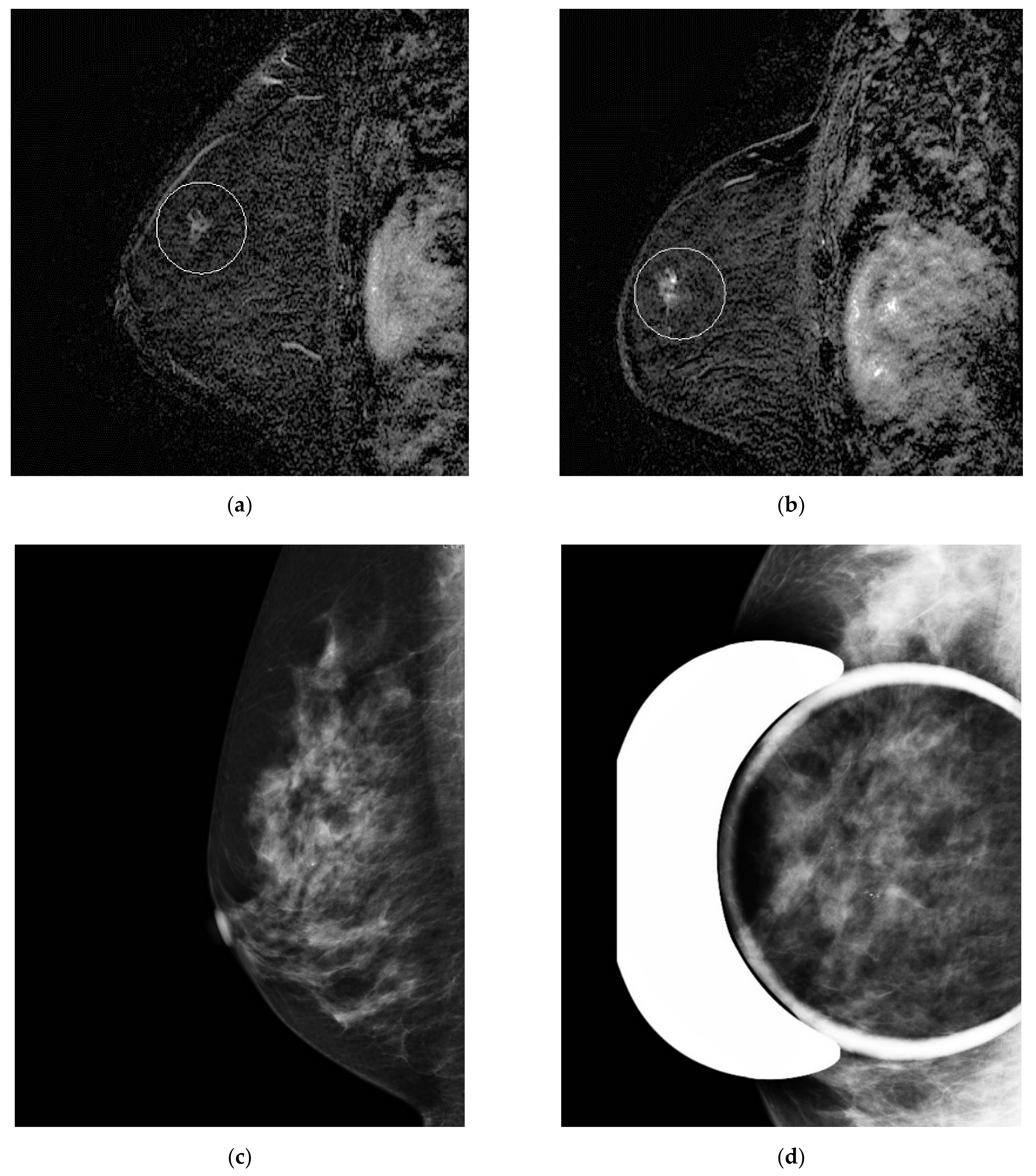 Tomography 08 00027 g003