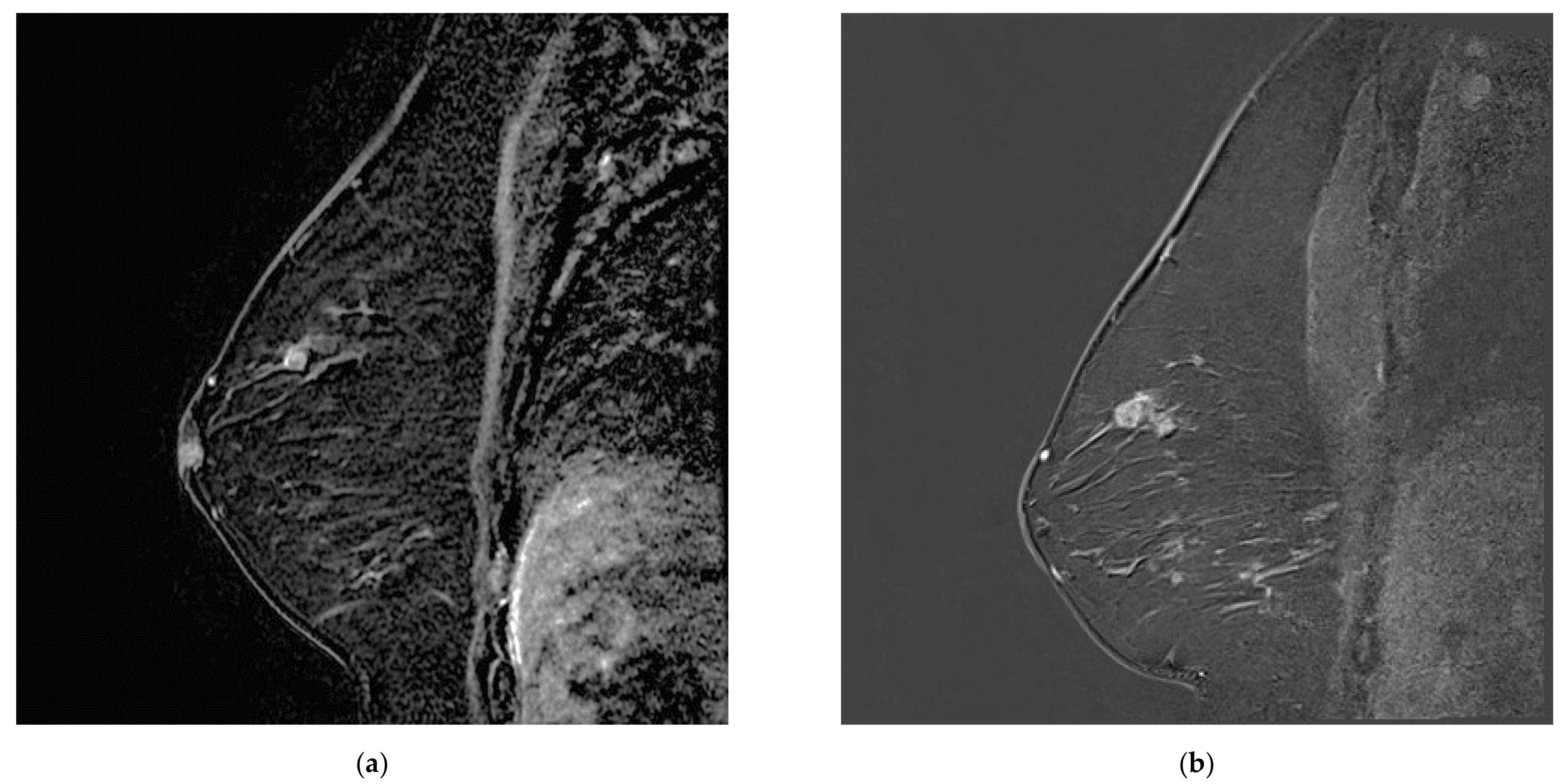 Tomography 08 00027 g004