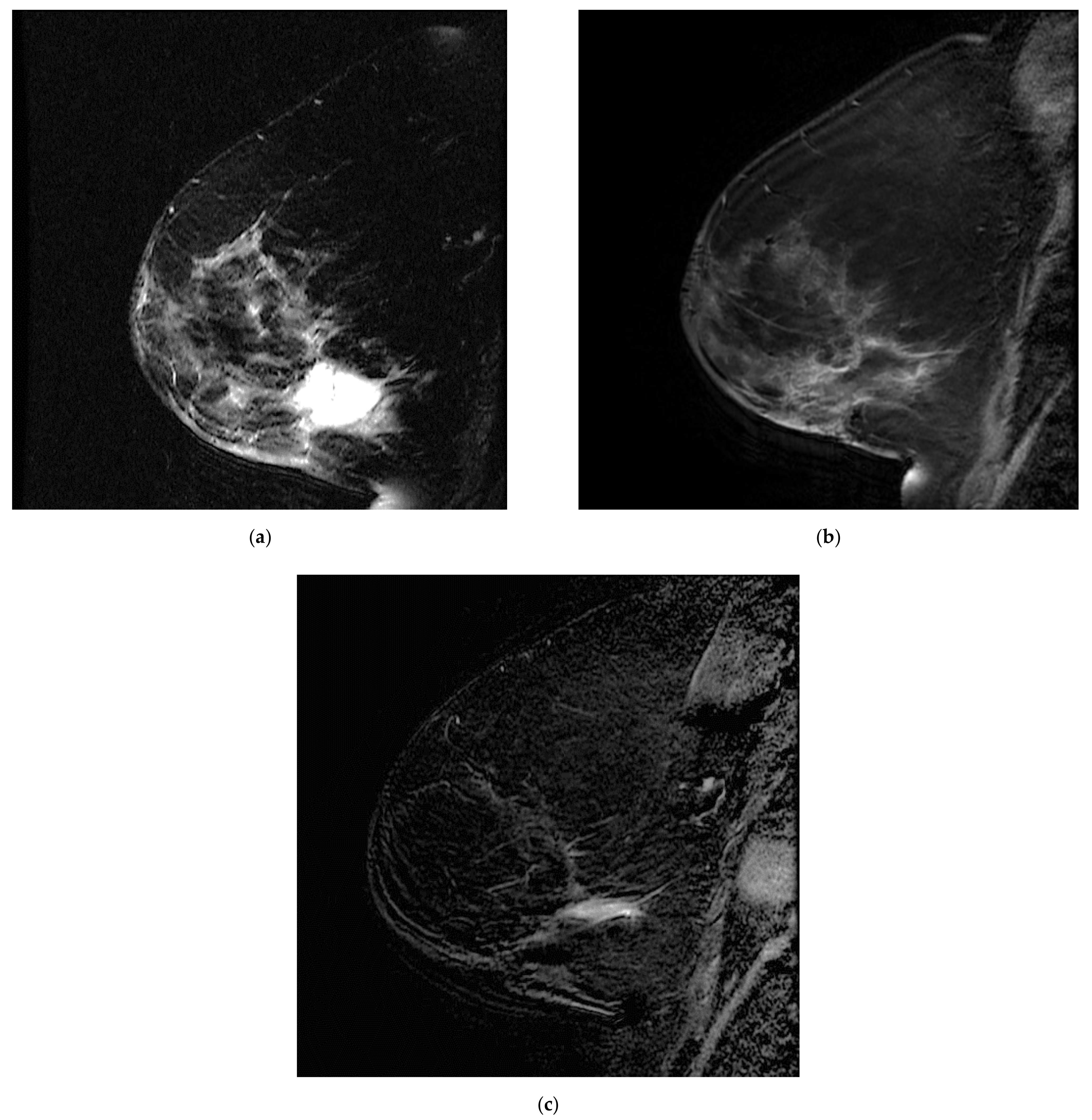 Tomography 08 00027 g005