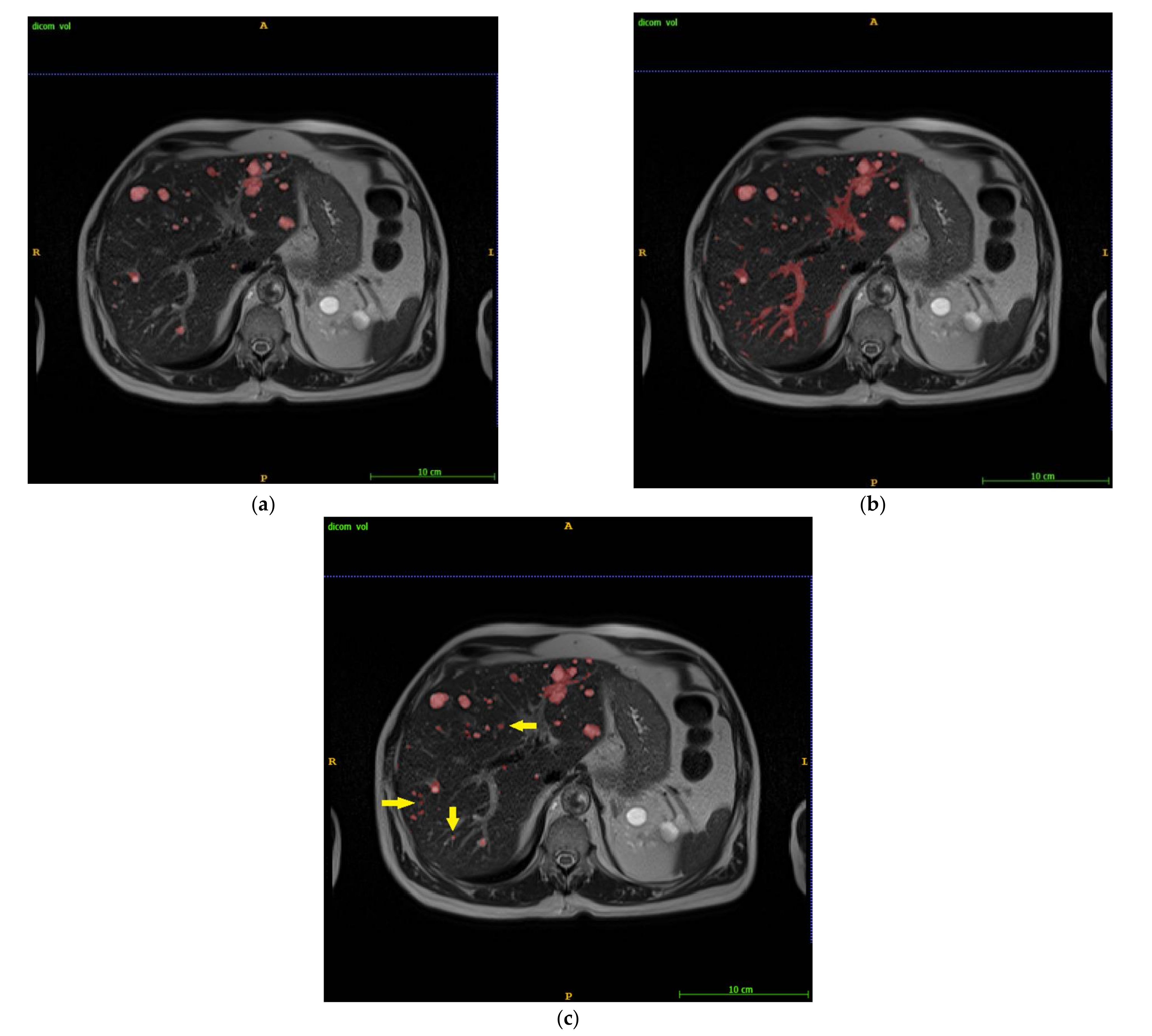 Tomography 08 00037 g001 Tomography 08 00037 g001