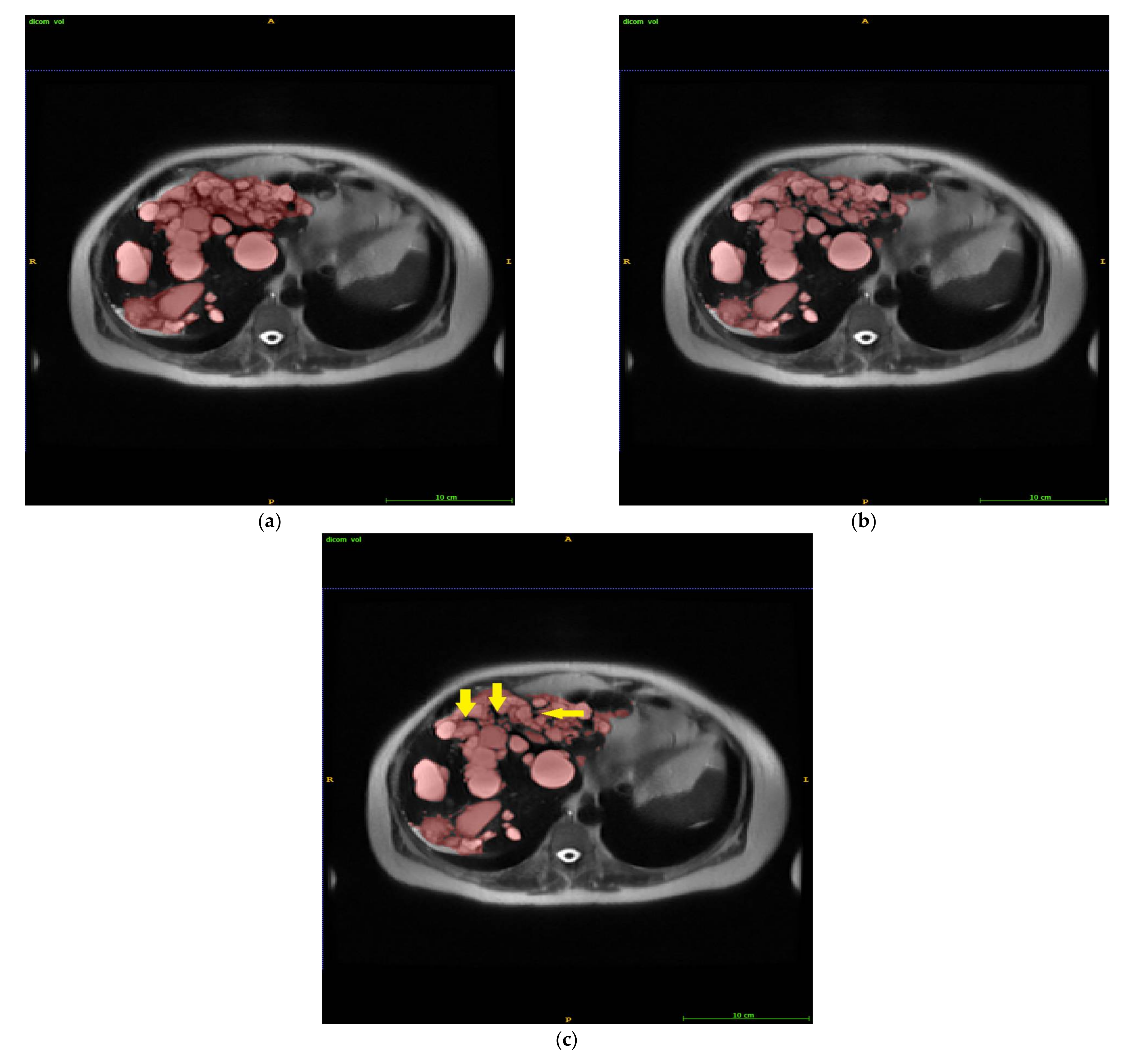 Tomography 08 00037 g004 Tomography 08 00037 g004