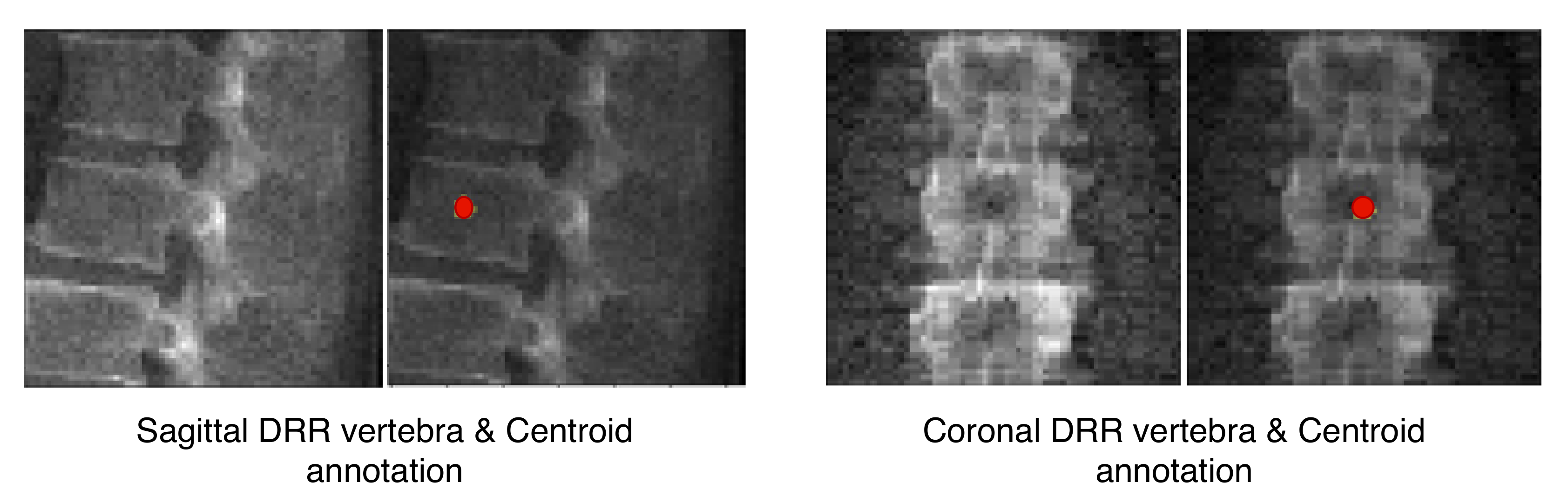 Tomography 08 00039 g002 Tomography 08 00039 g002