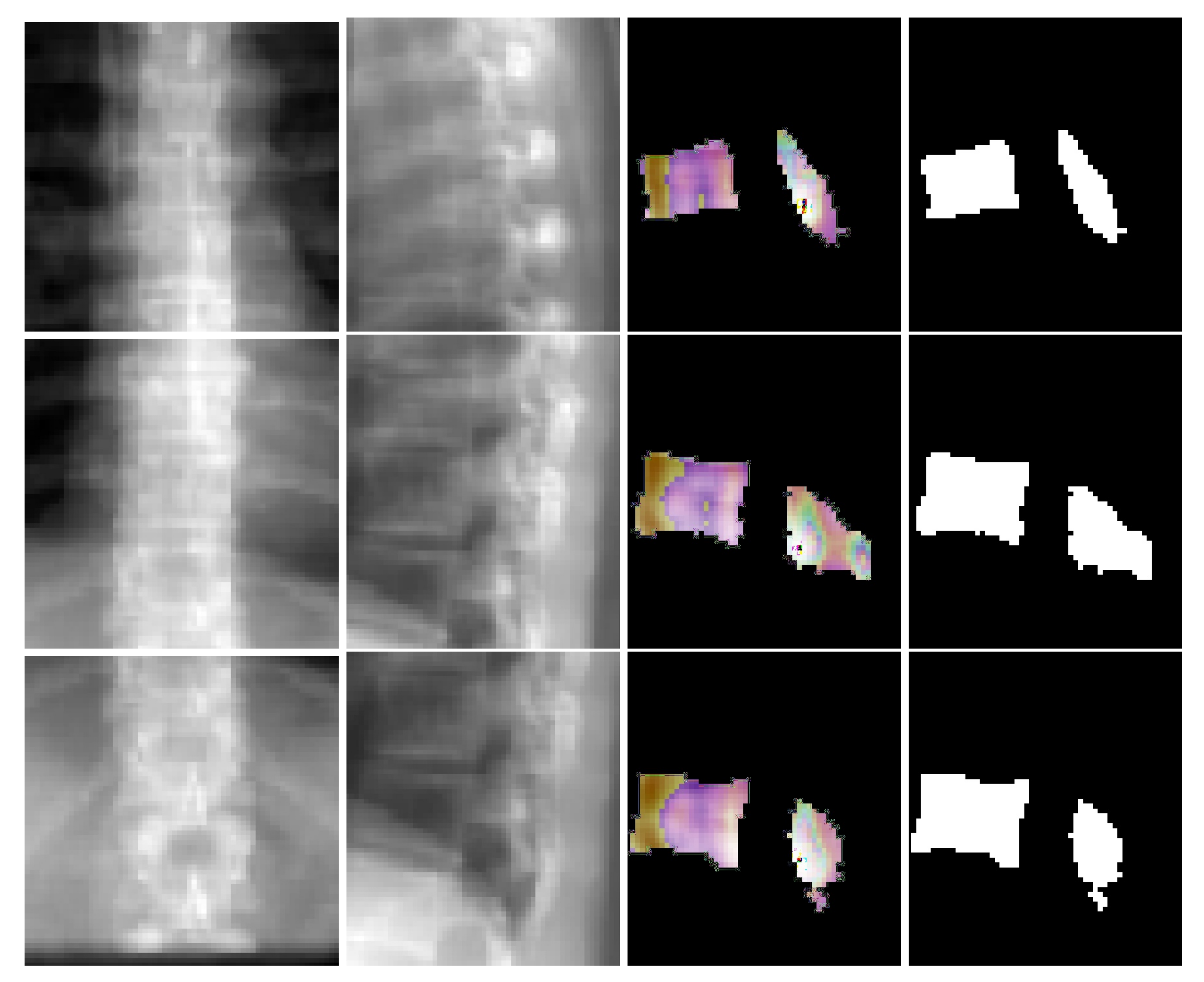 Tomography 08 00039 g006 Tomography 08 00039 g006