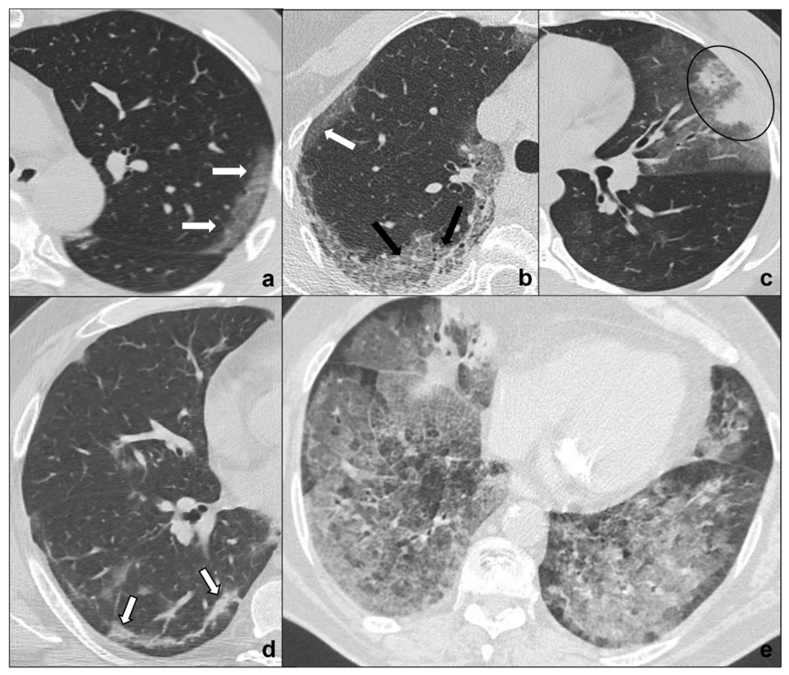 Tomography 08 00041 g001