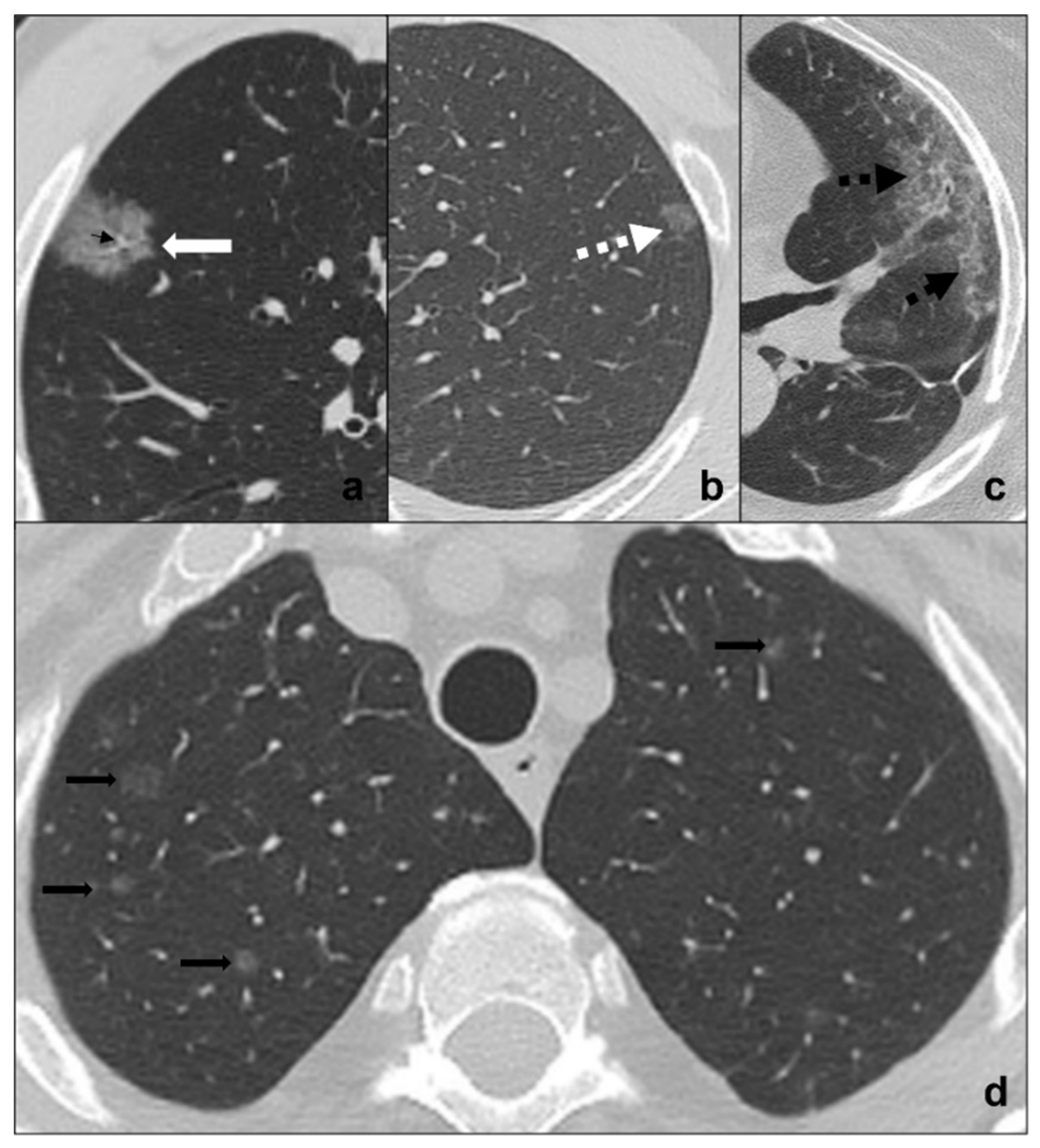 Tomography 08 00041 g002