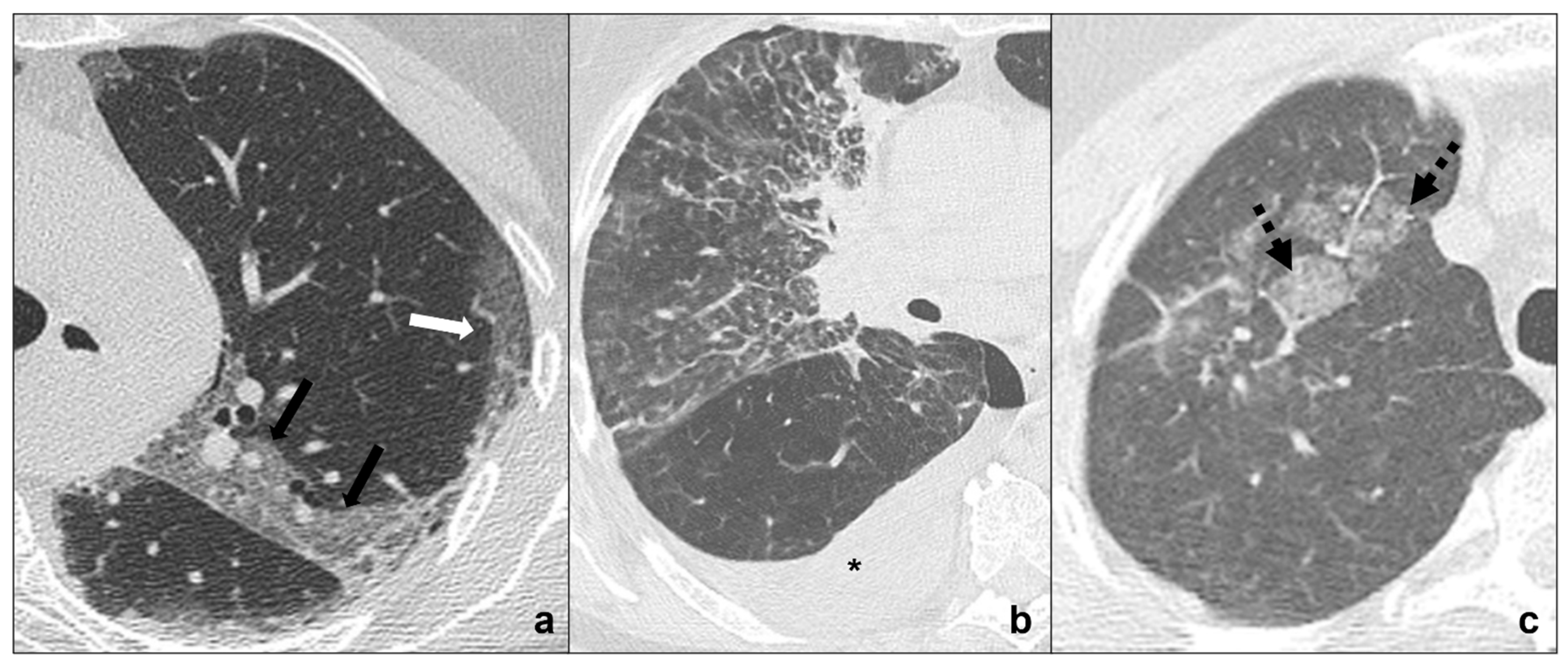 Tomography 08 00041 g003