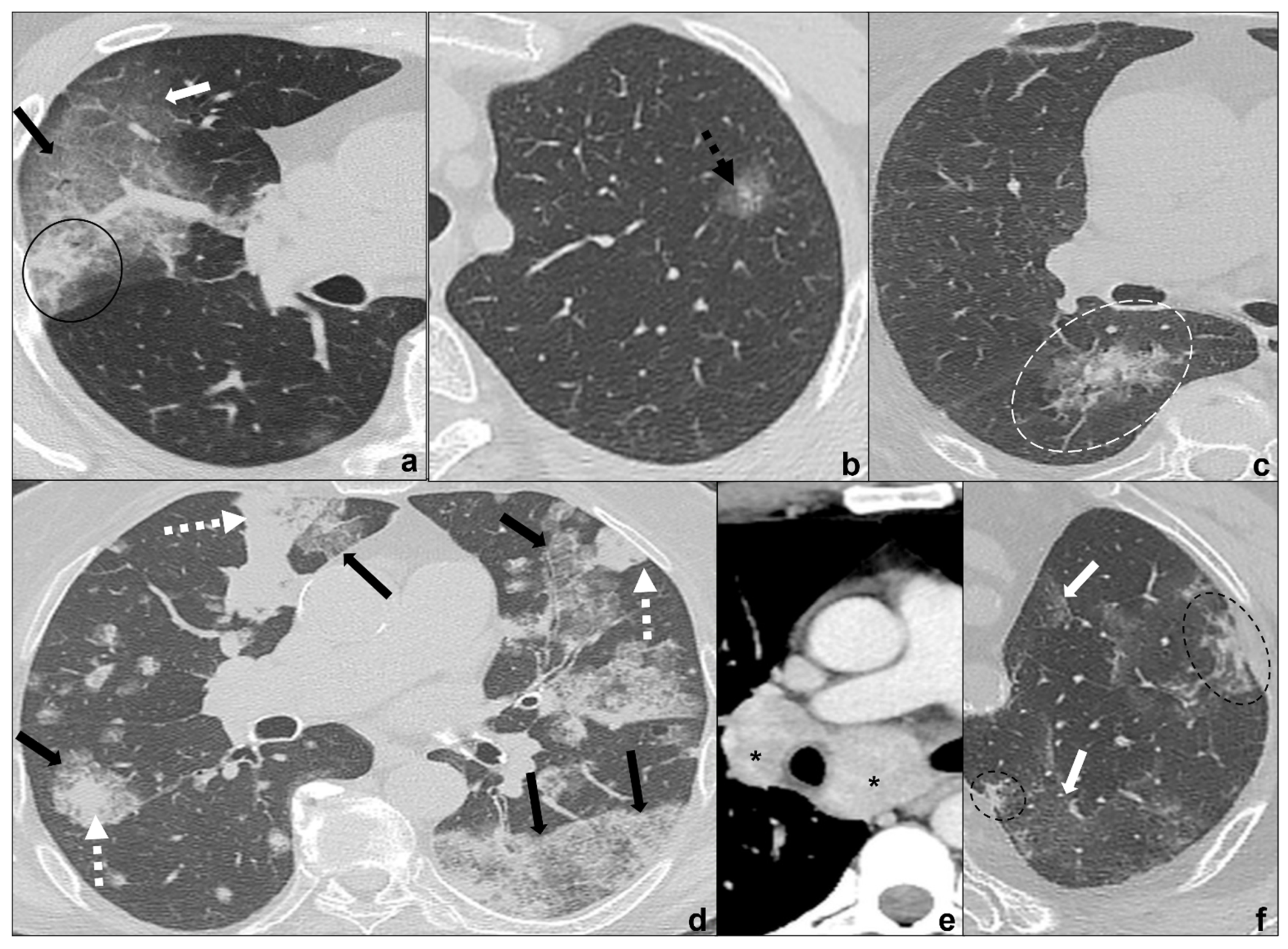 Tomography 08 00041 g004
