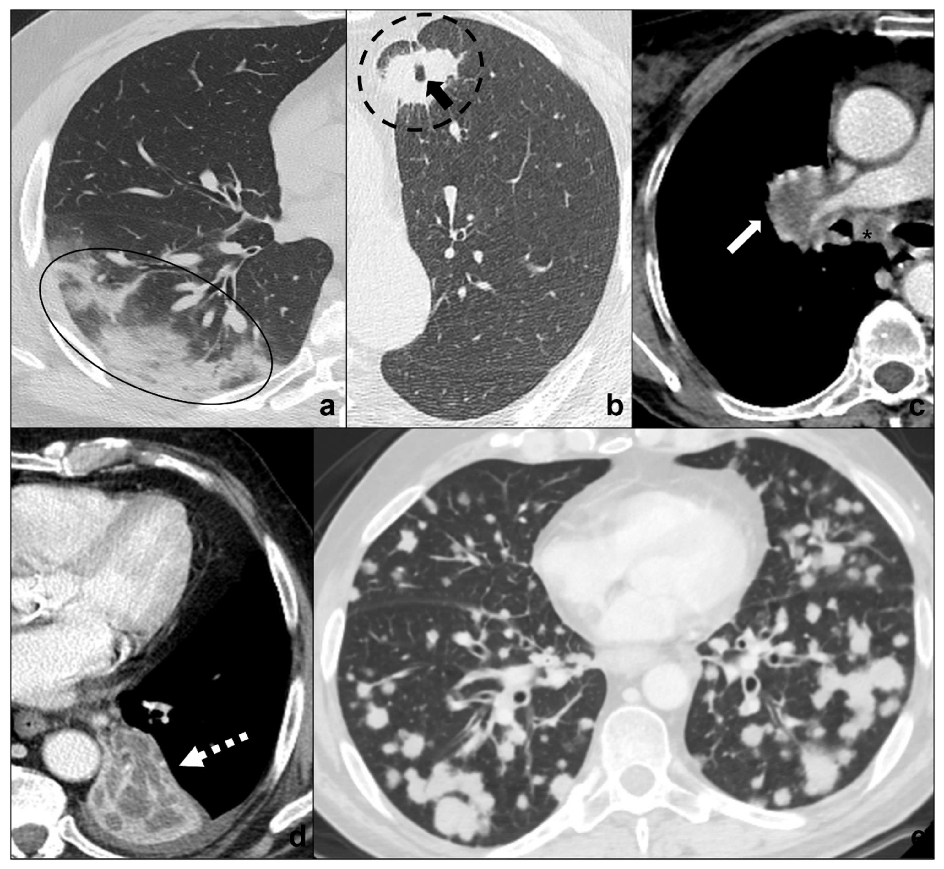 Tomography 08 00041 g005