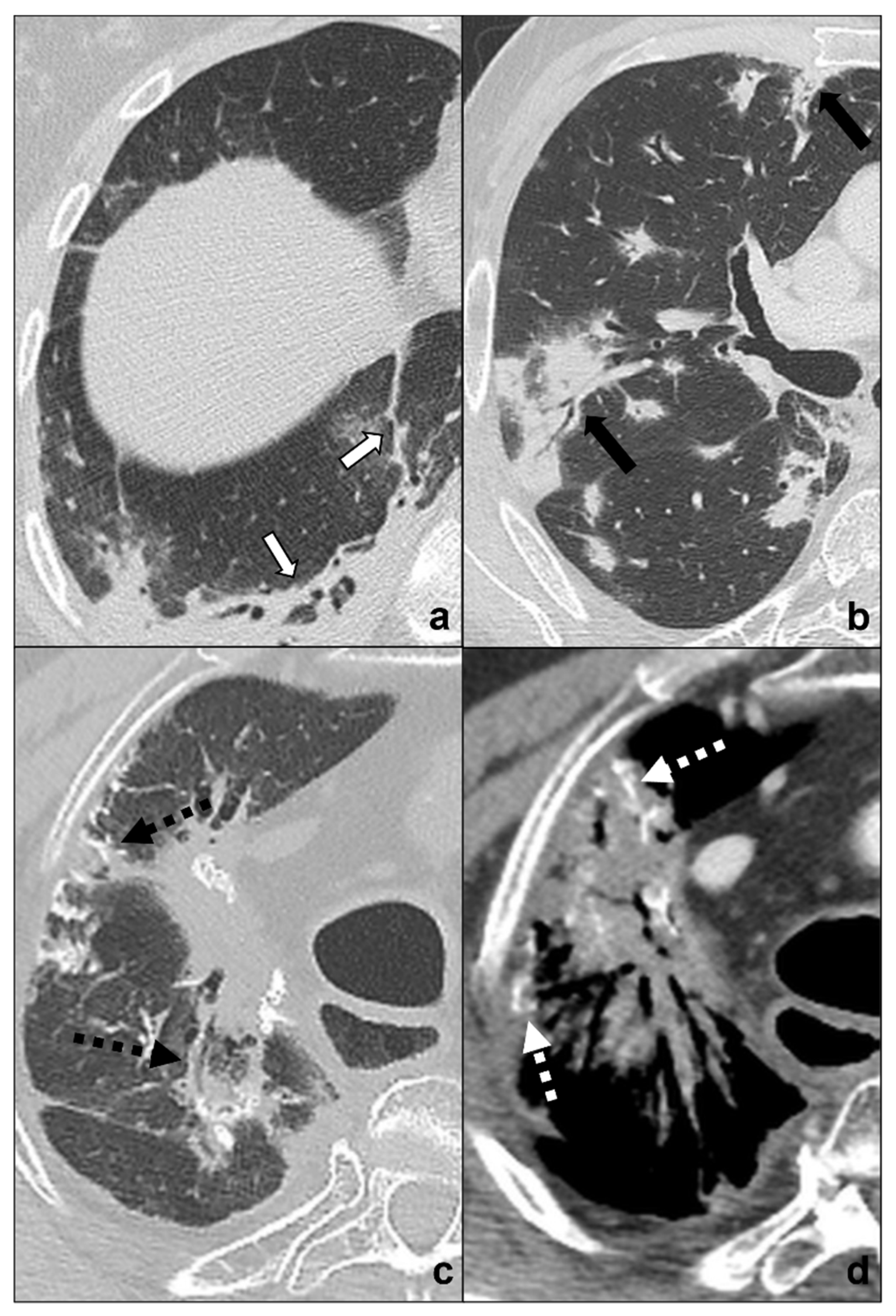 Tomography 08 00041 g006