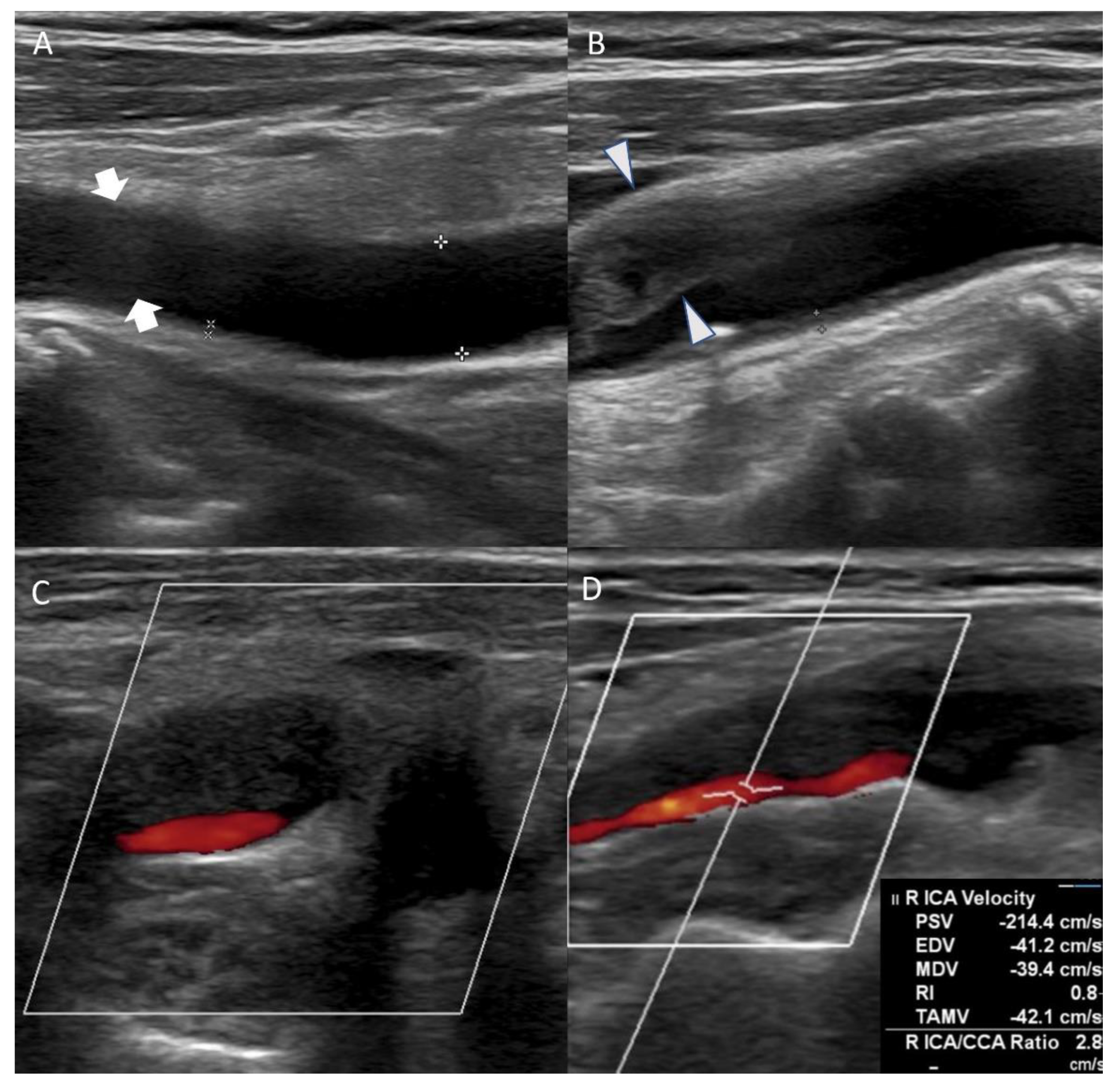 Tomography 08 00044 g002