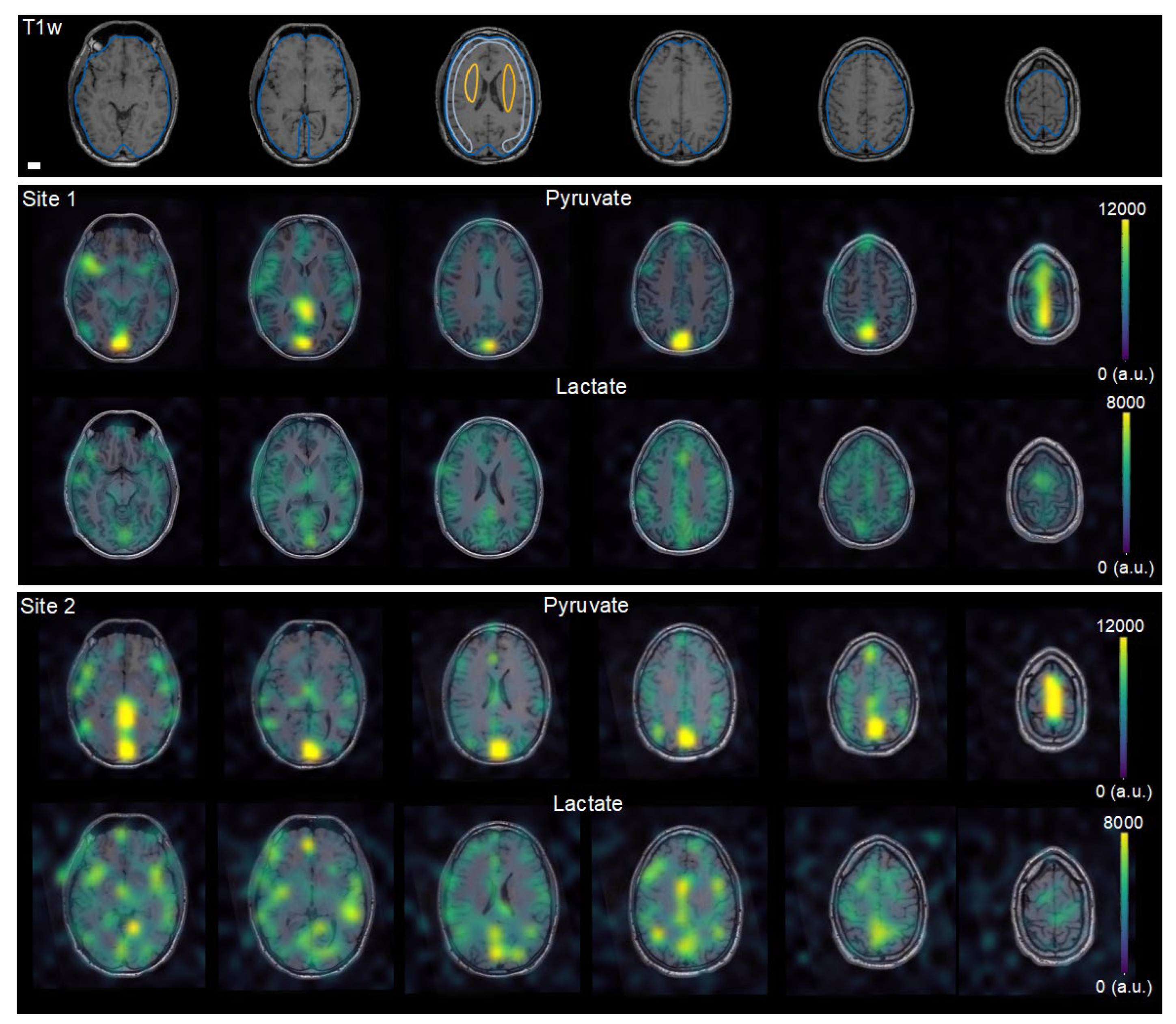 Tomography 08 00048 g002