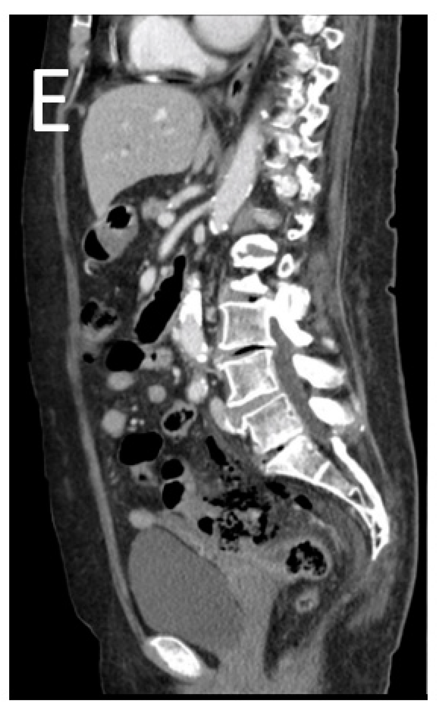 Tomography 08 00056 g011b Tomography 08 00056 g011b