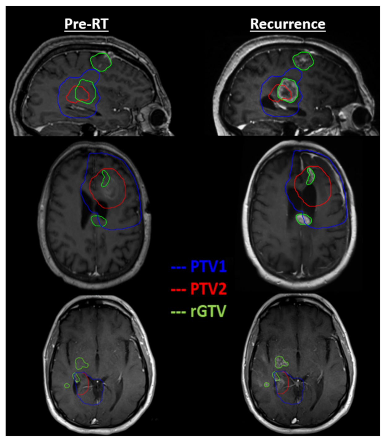 Tomography 08 00057 g003