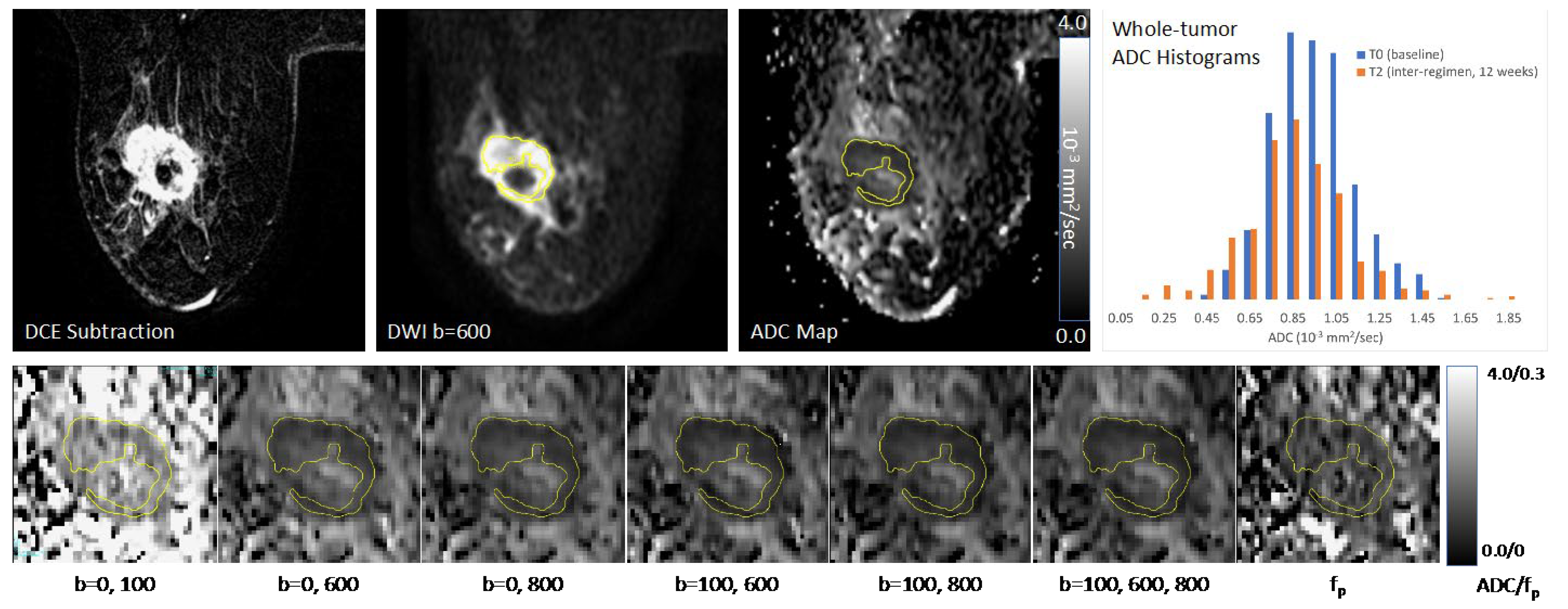 Tomography 08 00058 g003