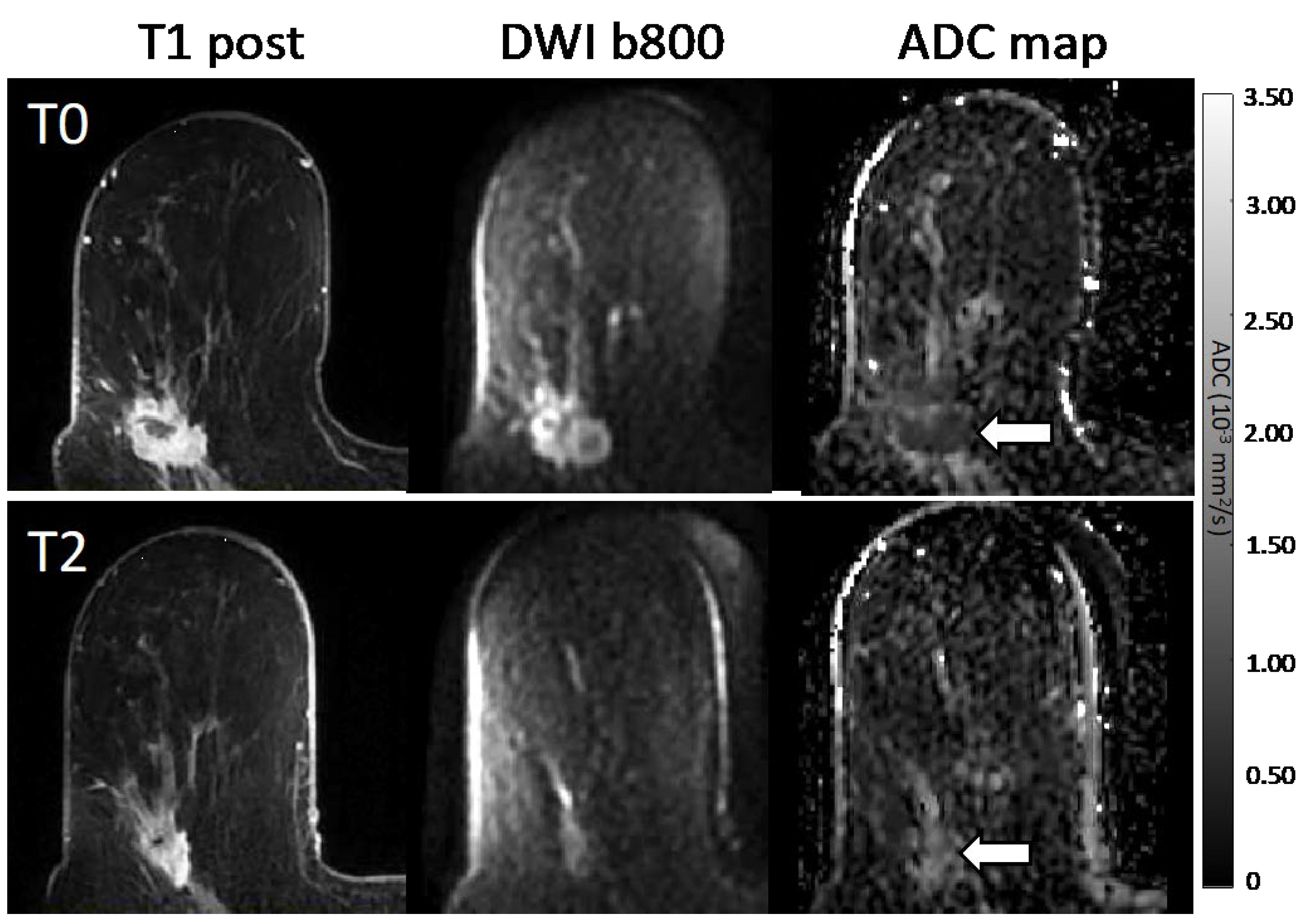 Tomography 08 00058 g004