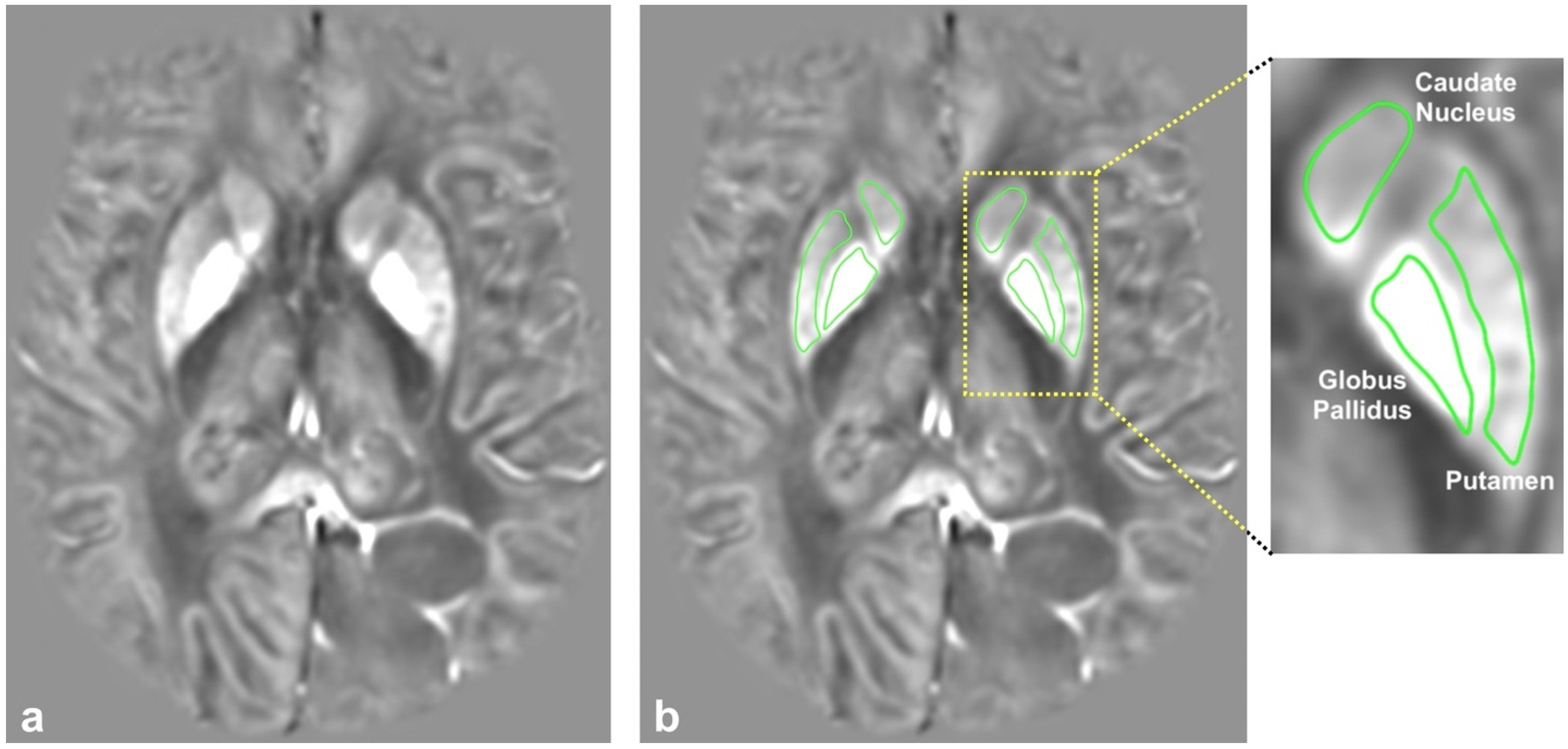 Tomography 08 00065 g001