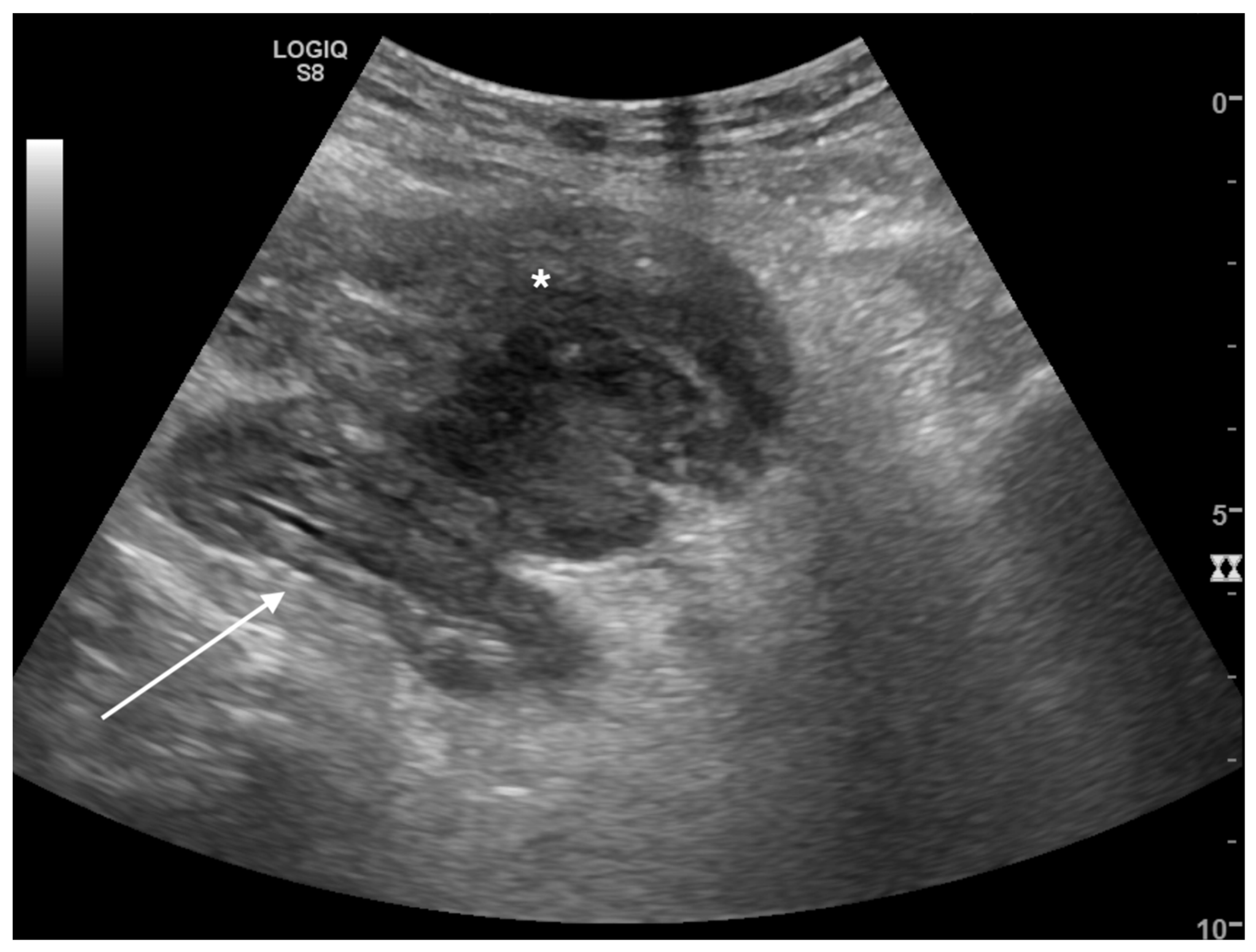 Tomography 08 00066 g003