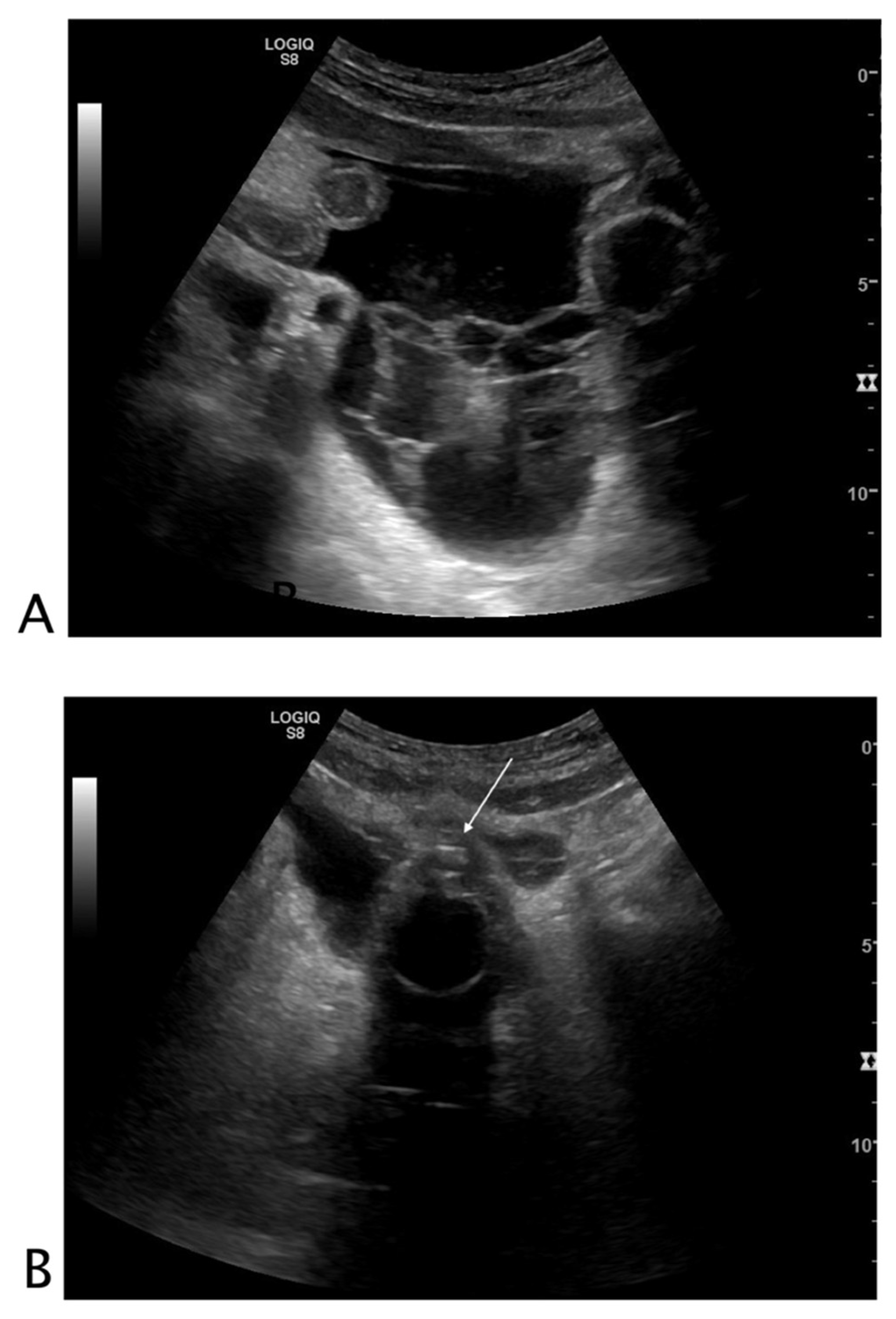 Tomography 08 00066 g004