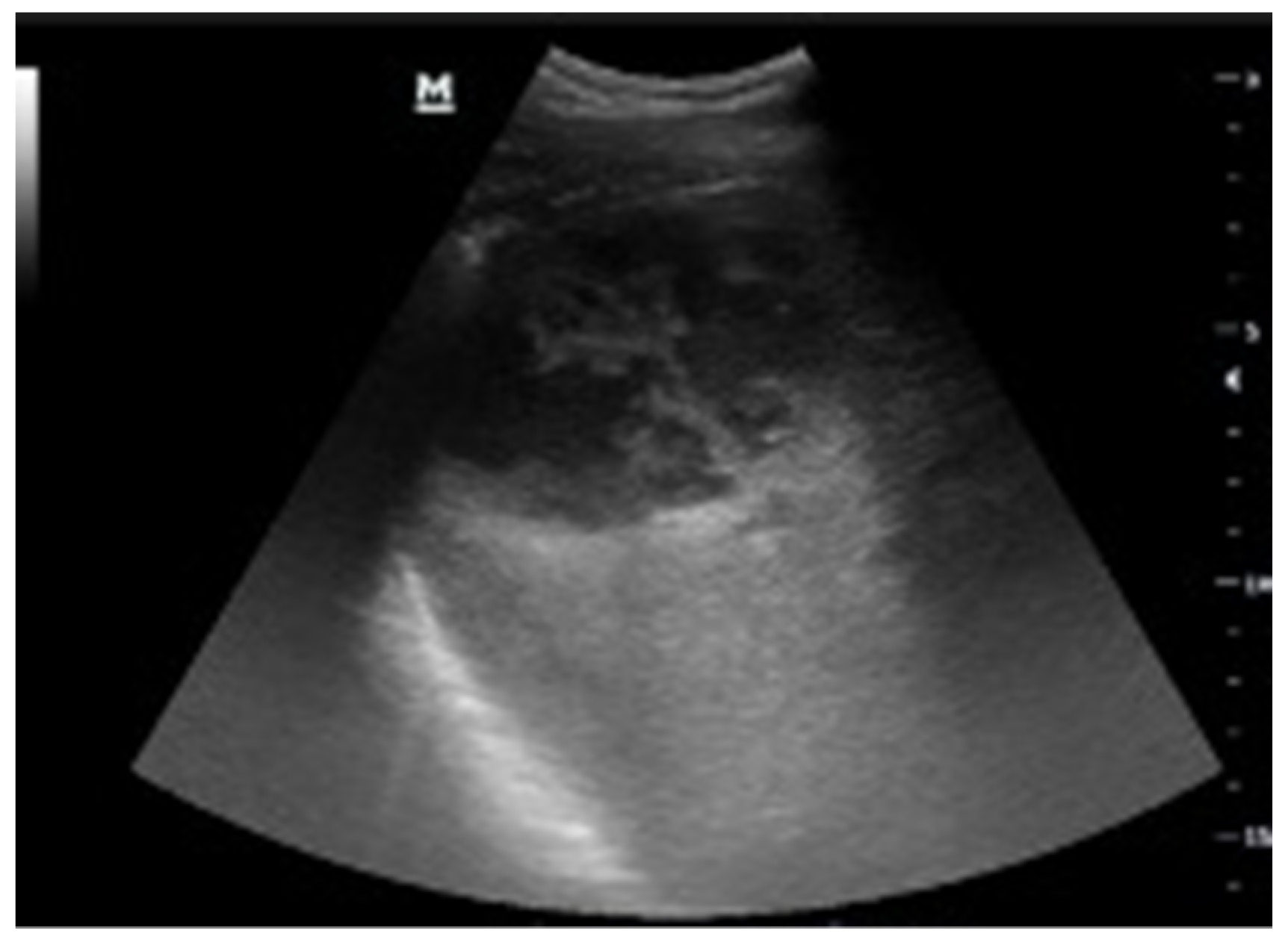 Tomography 08 00066 g006