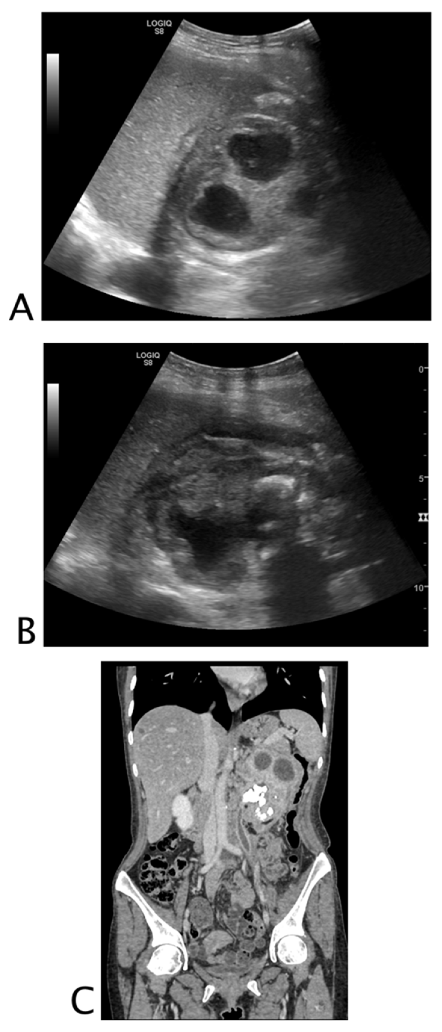 Tomography 08 00066 g010