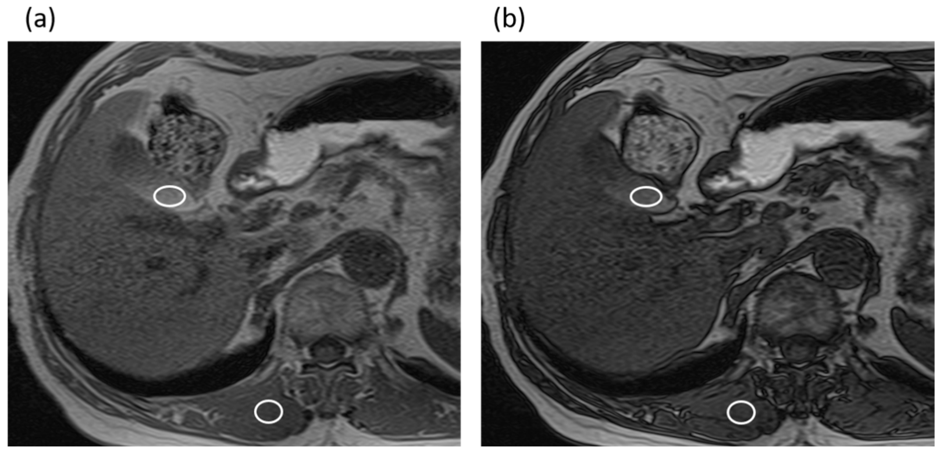 Tomography 08 00067 g002
