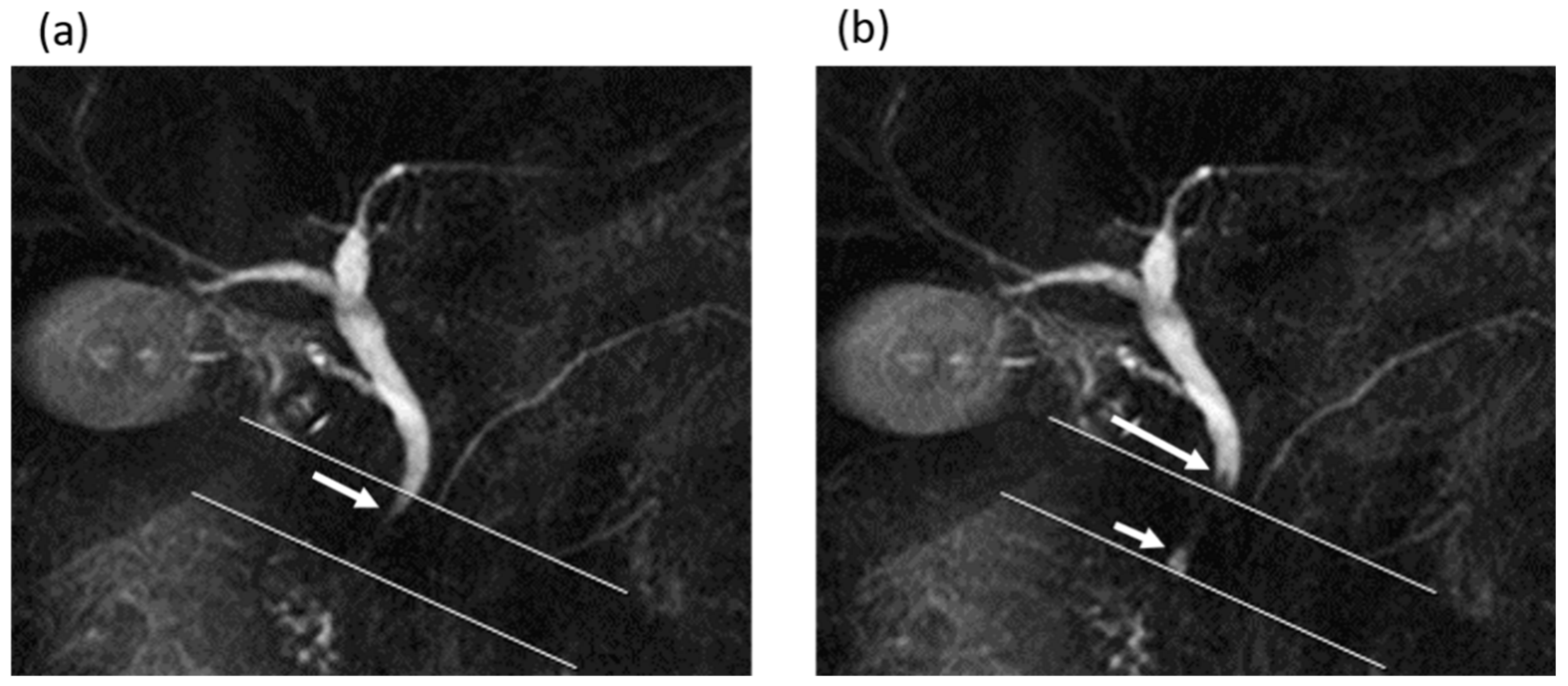 Tomography 08 00067 g003