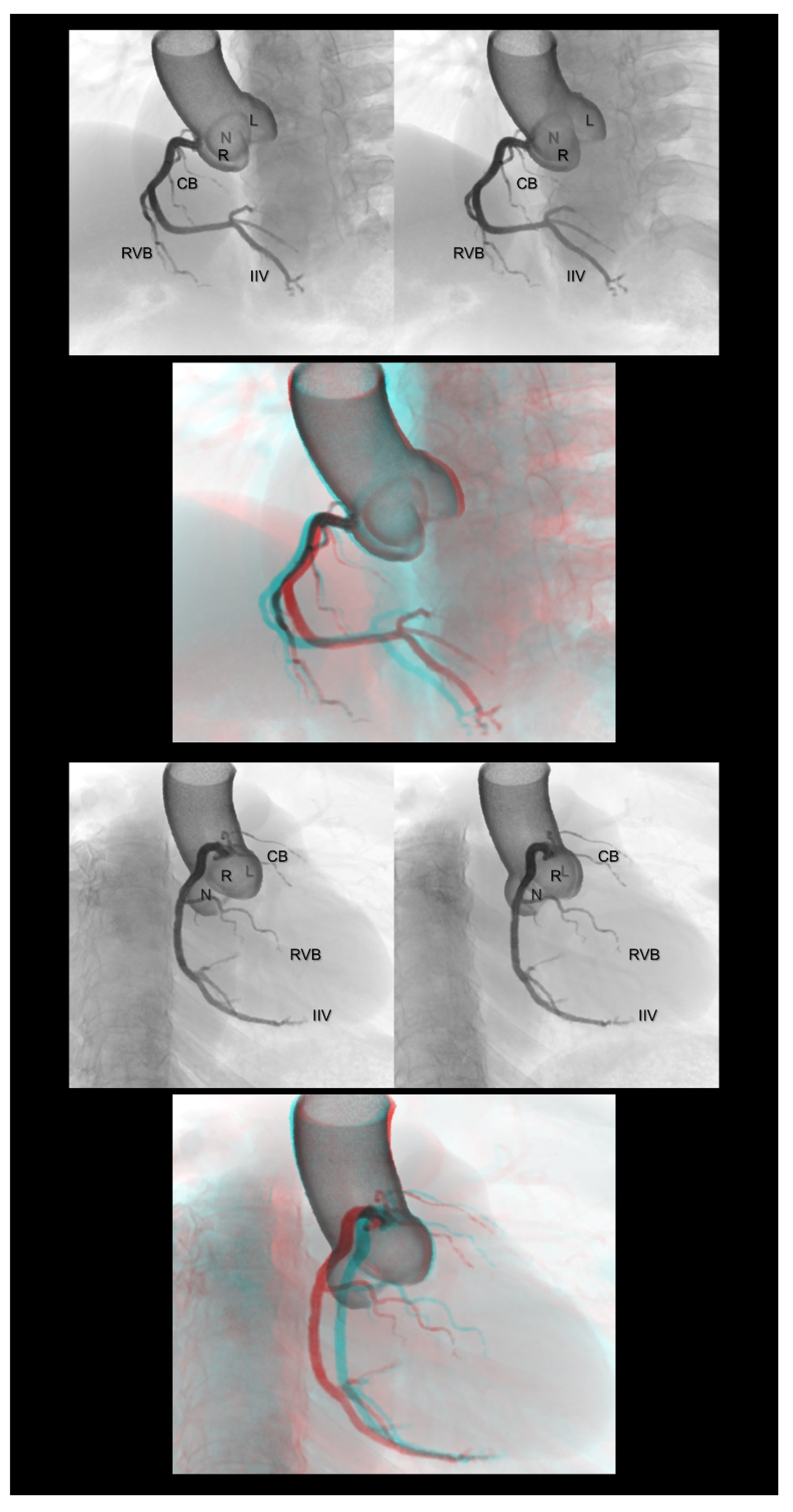 Tomography 08 00068 g002 Tomography 08 00068 g002