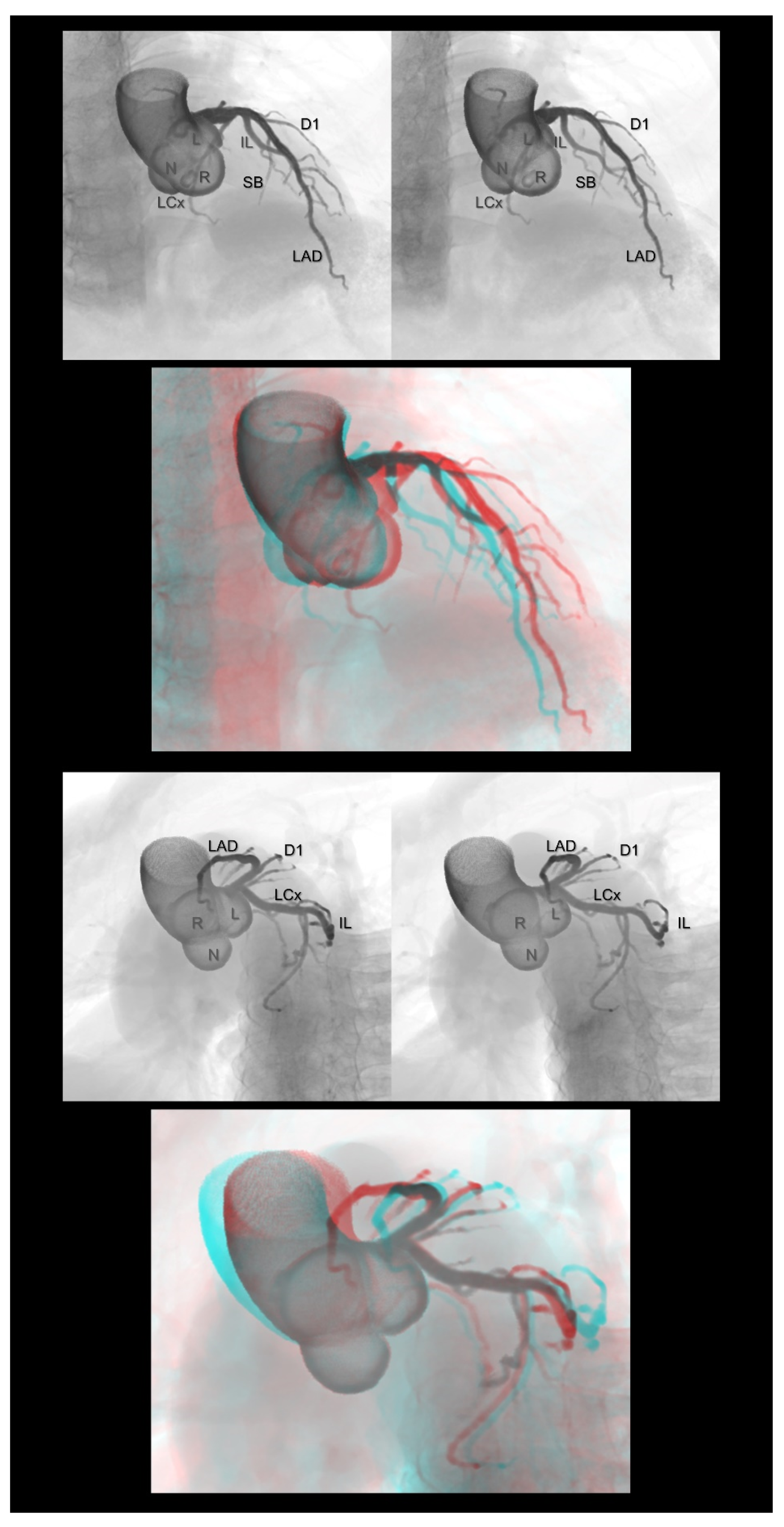 Tomography 08 00068 g003 Tomography 08 00068 g003