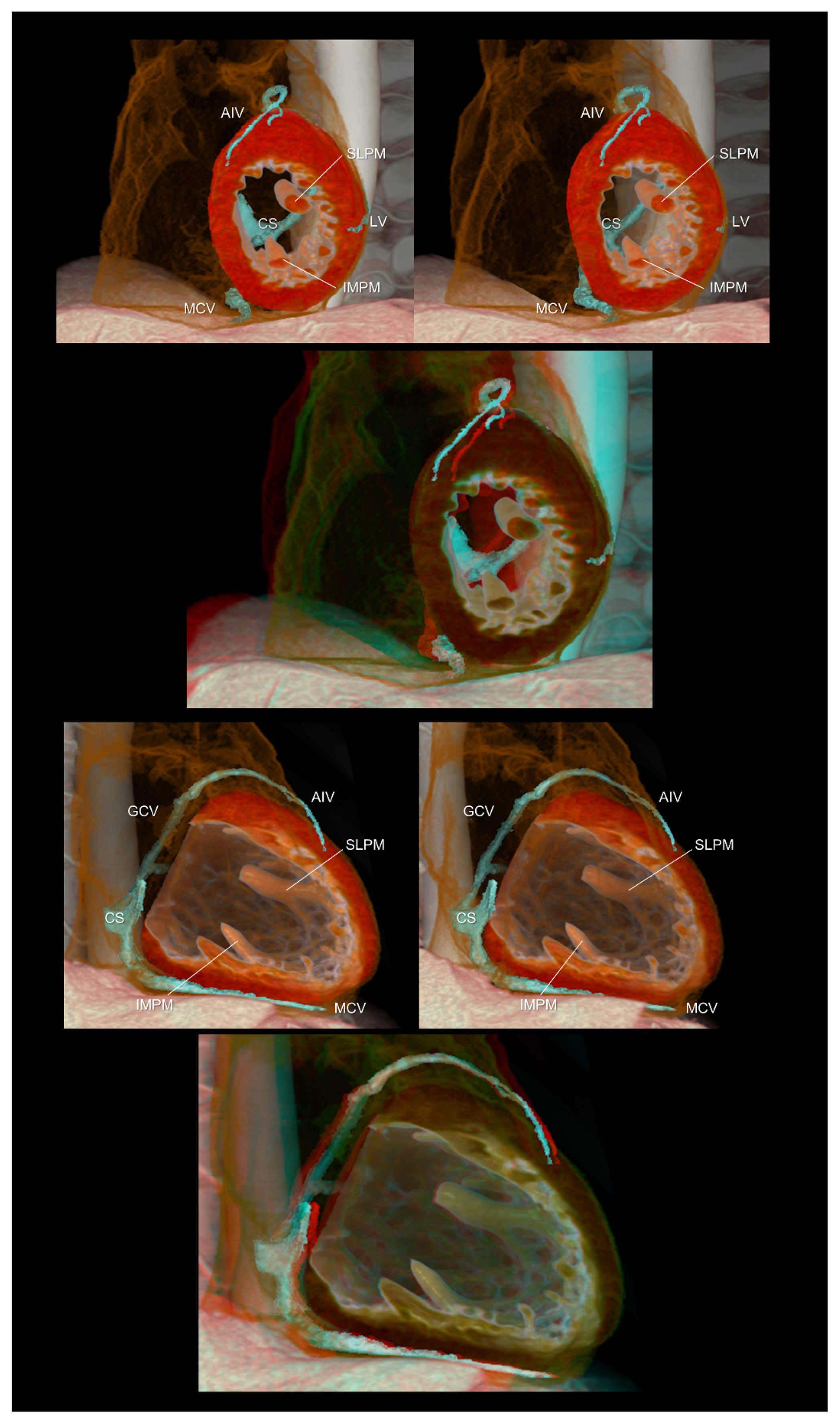 Tomography 08 00068 g004 Tomography 08 00068 g004