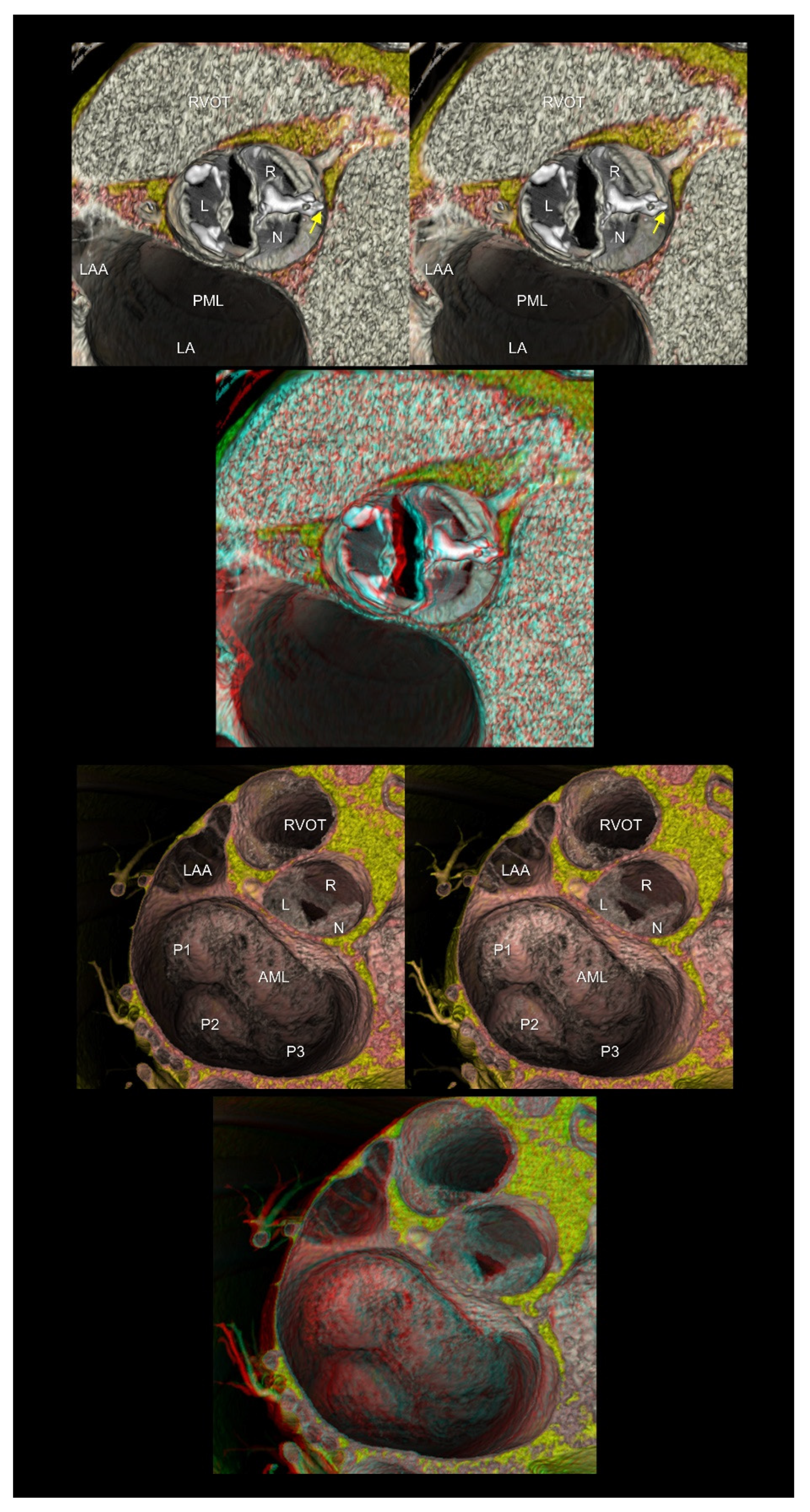 Tomography 08 00068 g006 Tomography 08 00068 g006