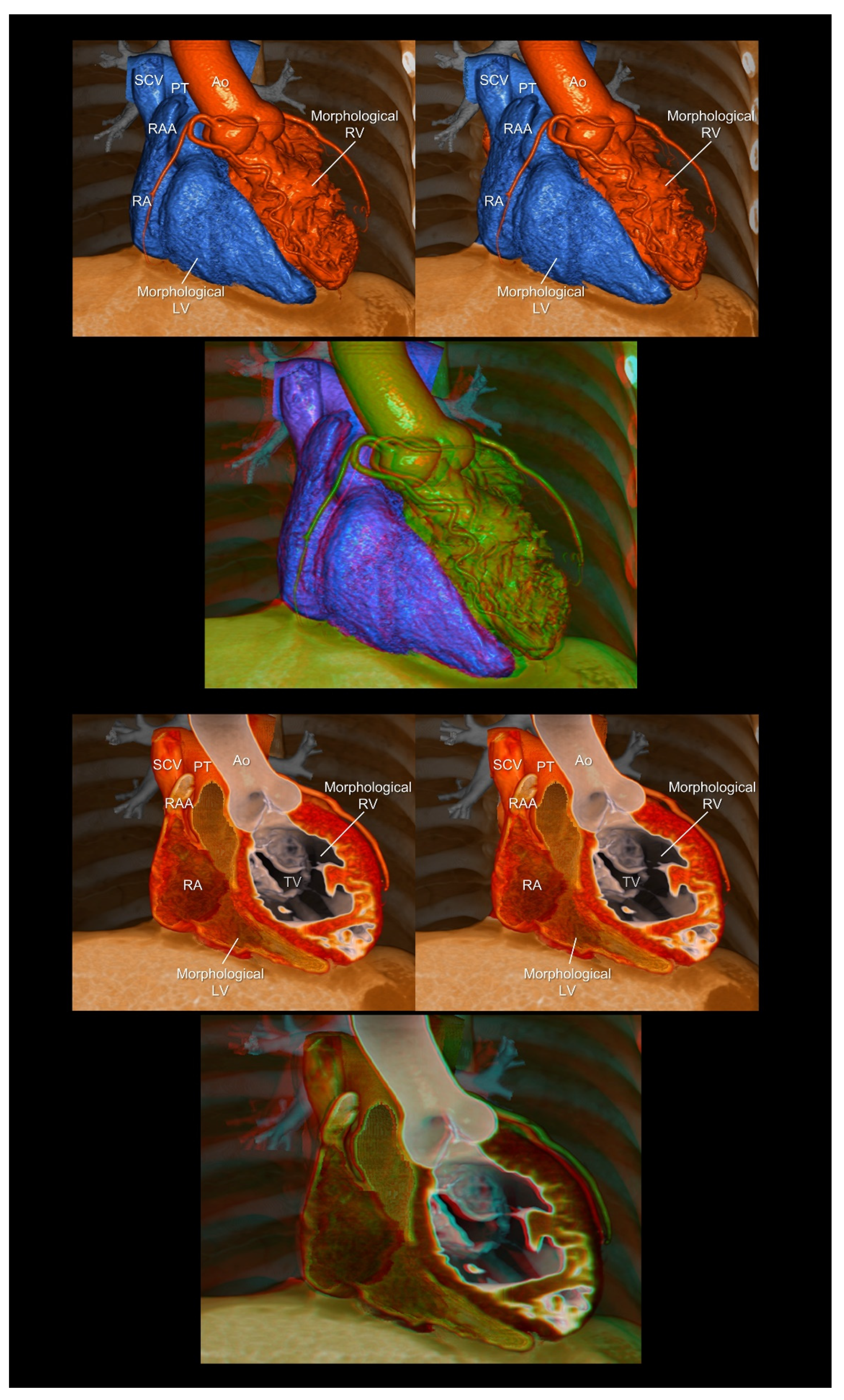 Tomography 08 00068 g007 Tomography 08 00068 g007