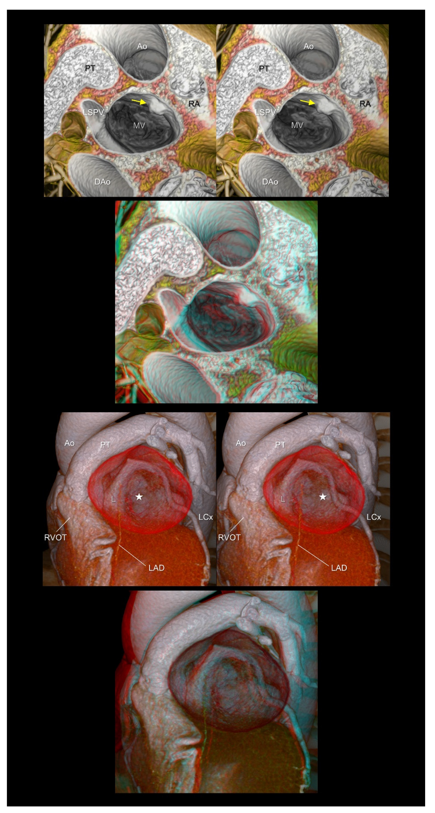 Tomography 08 00068 g009 Tomography 08 00068 g009