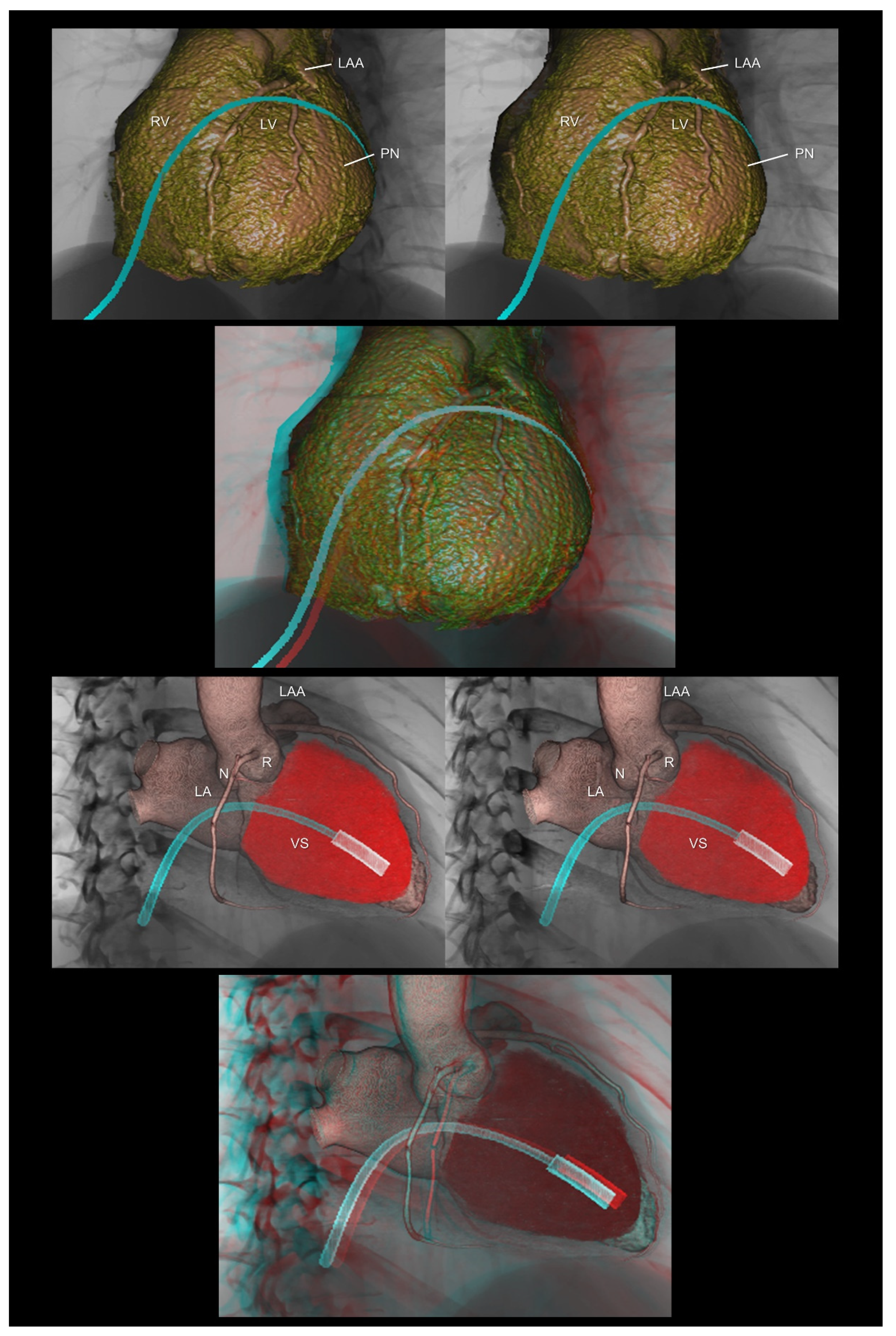 Tomography 08 00068 g010 Tomography 08 00068 g010
