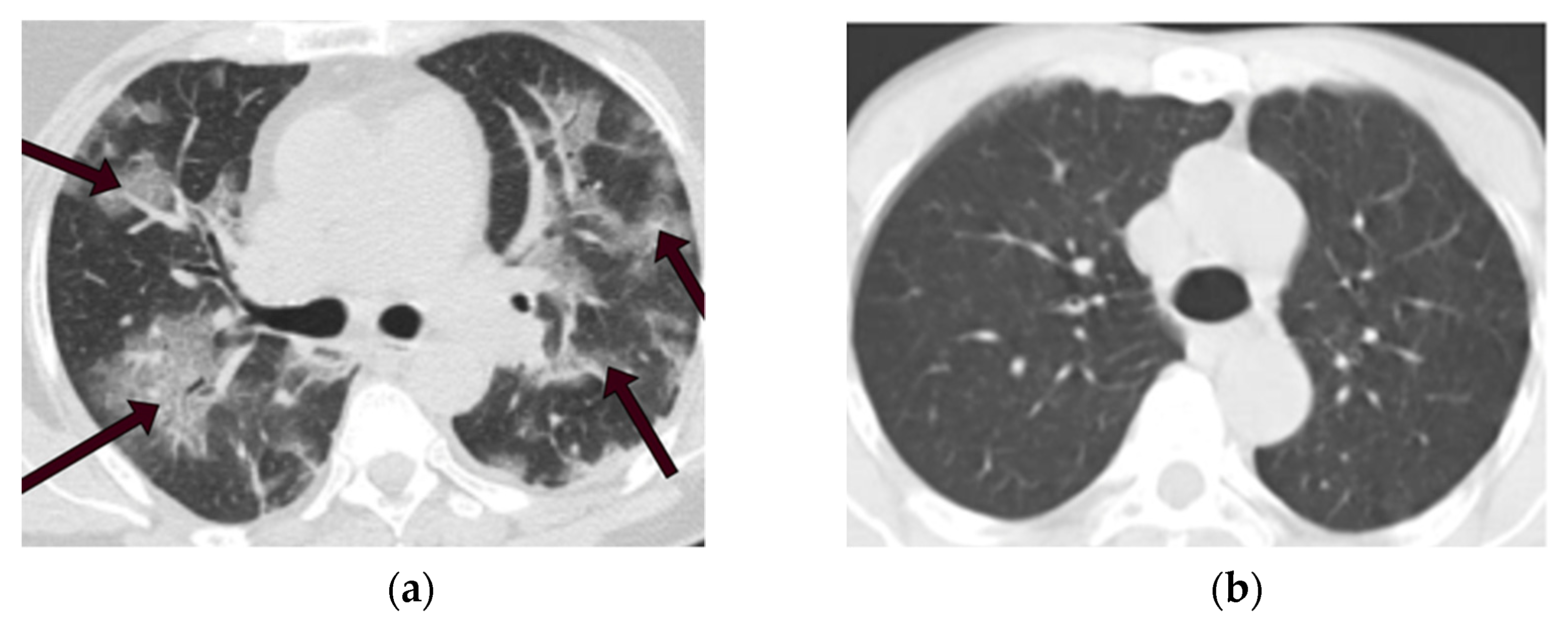 Tomography 08 00071 g002