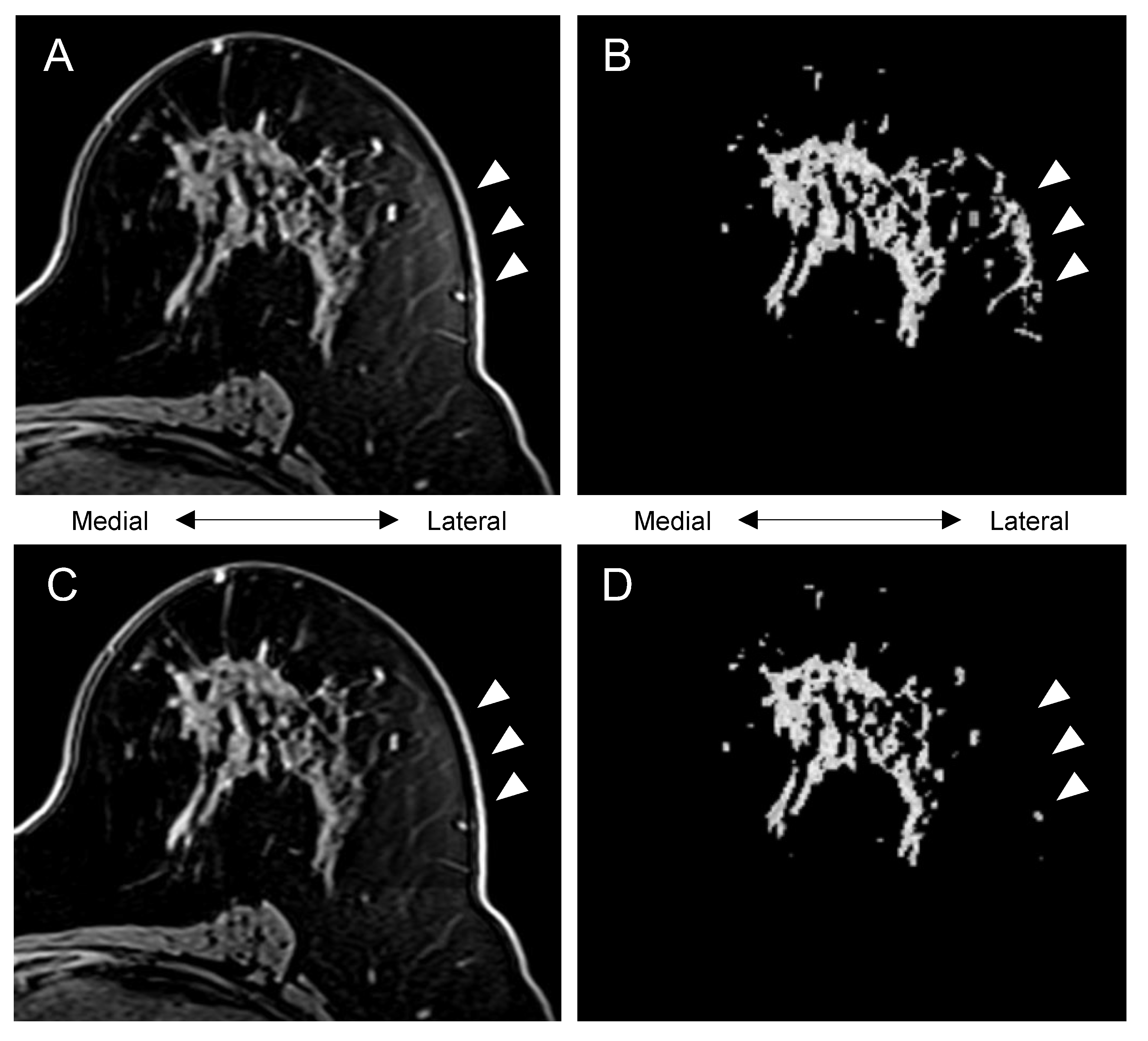 Tomography 08 00072 g003