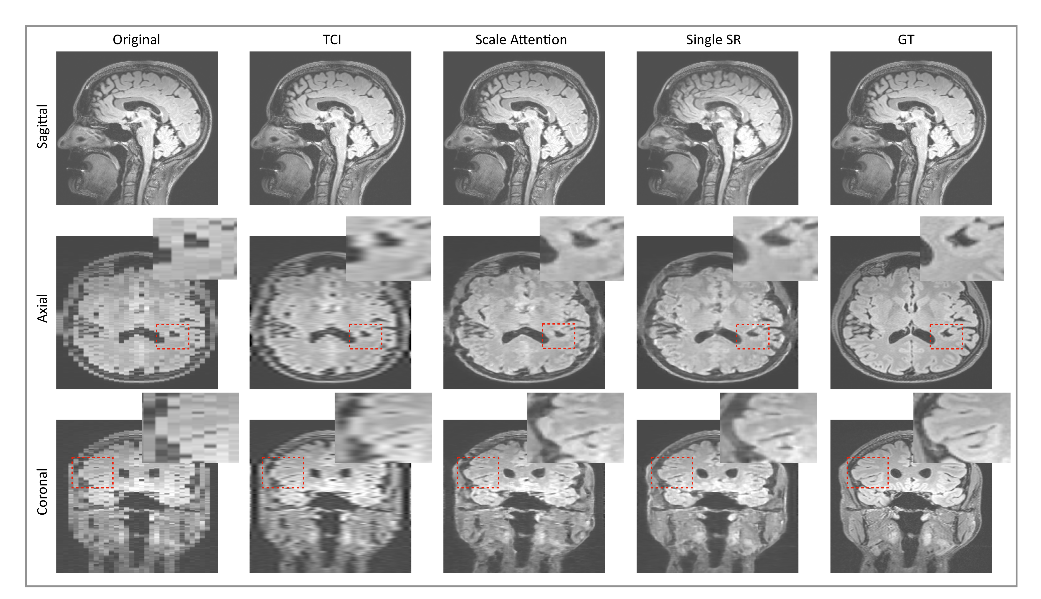 Tomography 08 00073 g004