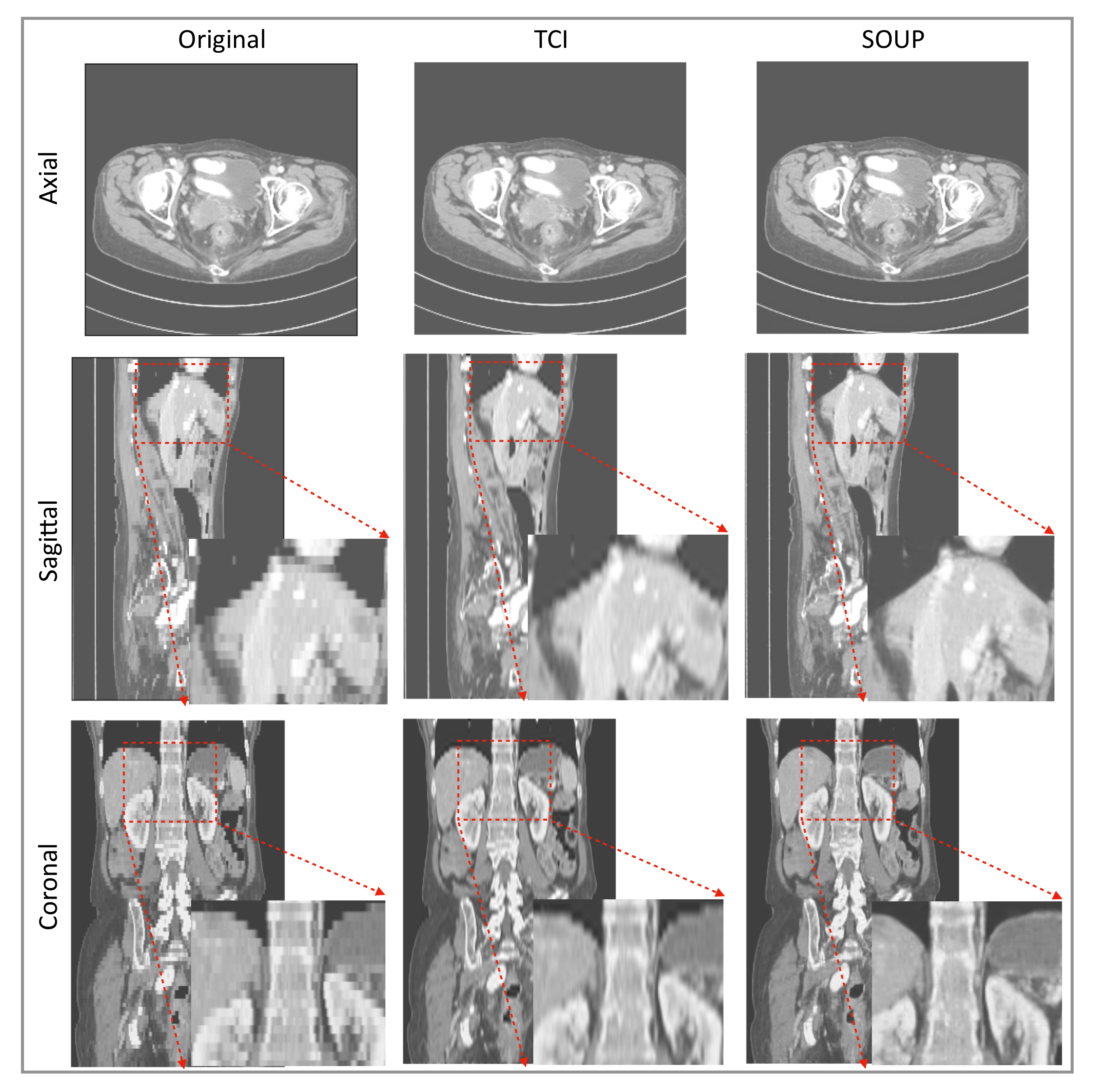 Tomography 08 00073 g006