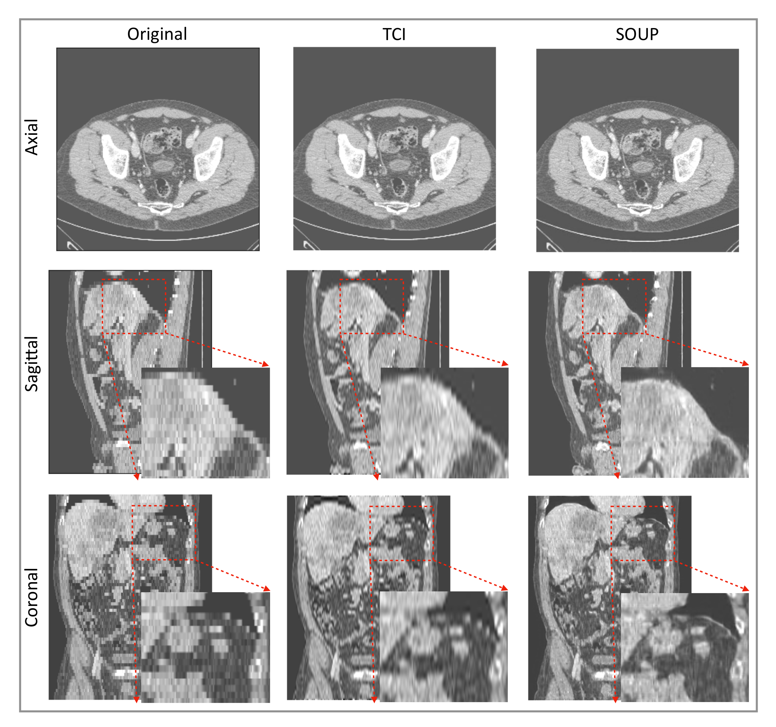 Tomography 08 00073 g007
