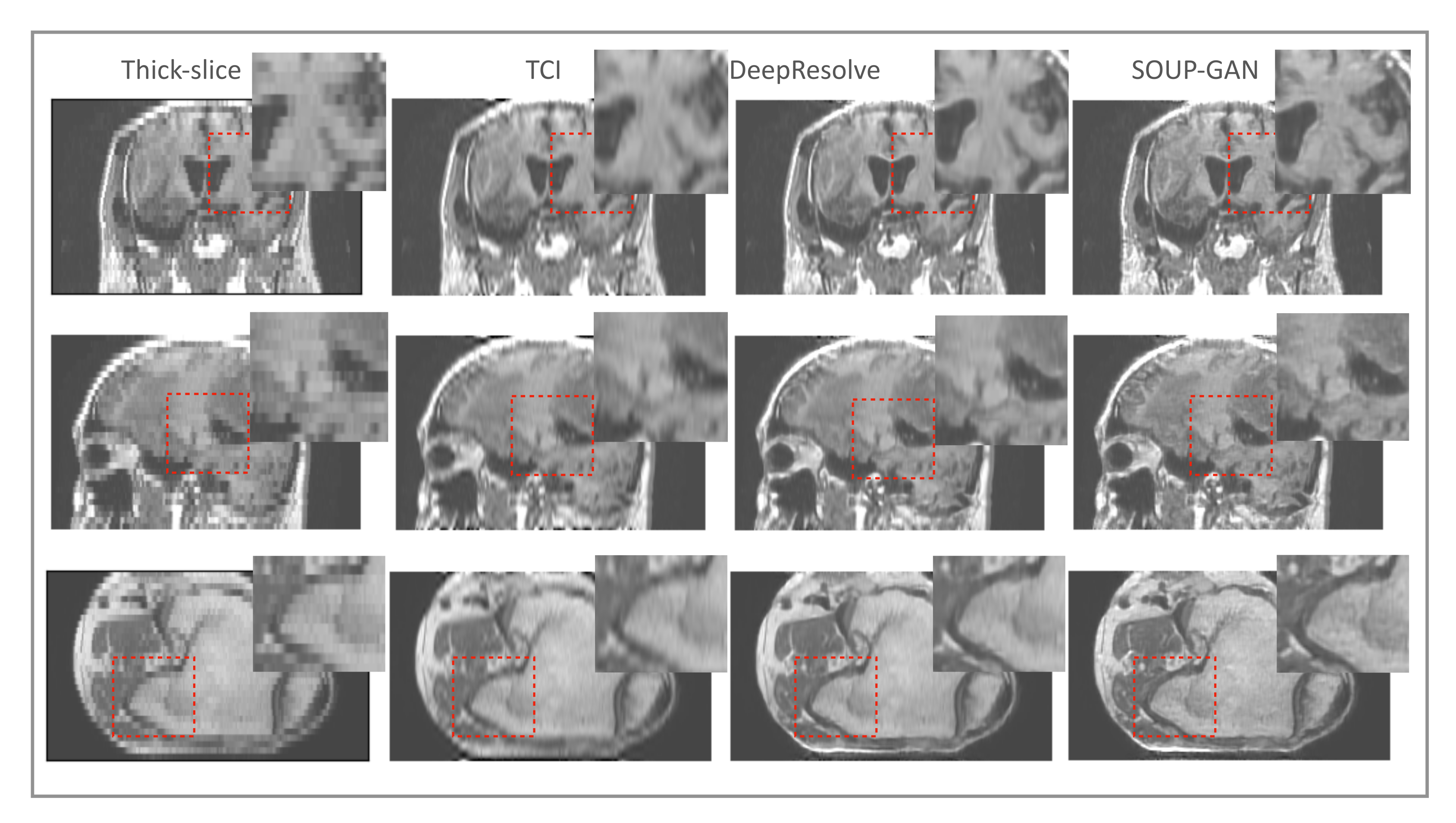 Tomography 08 00073 g008