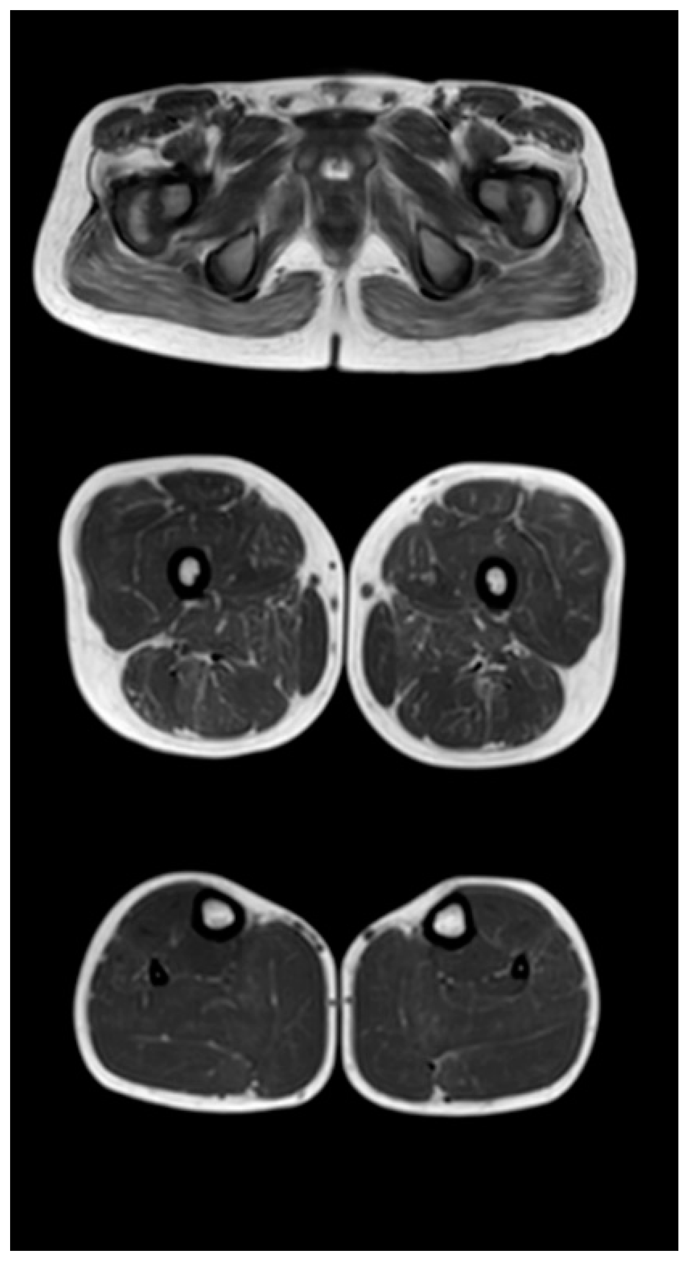 Tomography 08 00076 g003